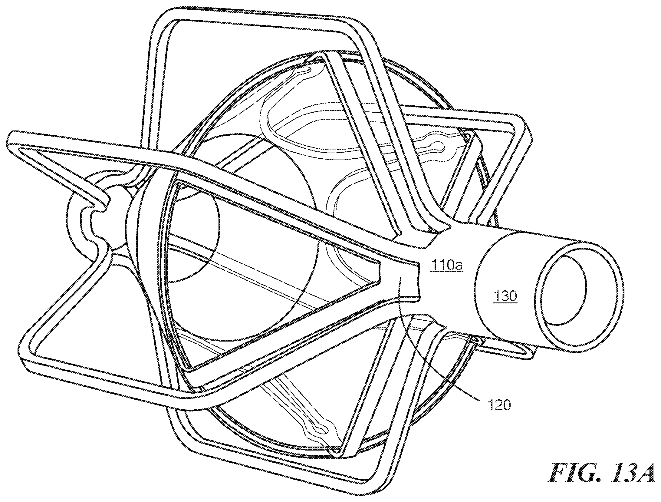 Patent US12588909 Figure 16 – Transcatheter device and minimally invasive method for constricting and adjusting blood flow through a blood vessel