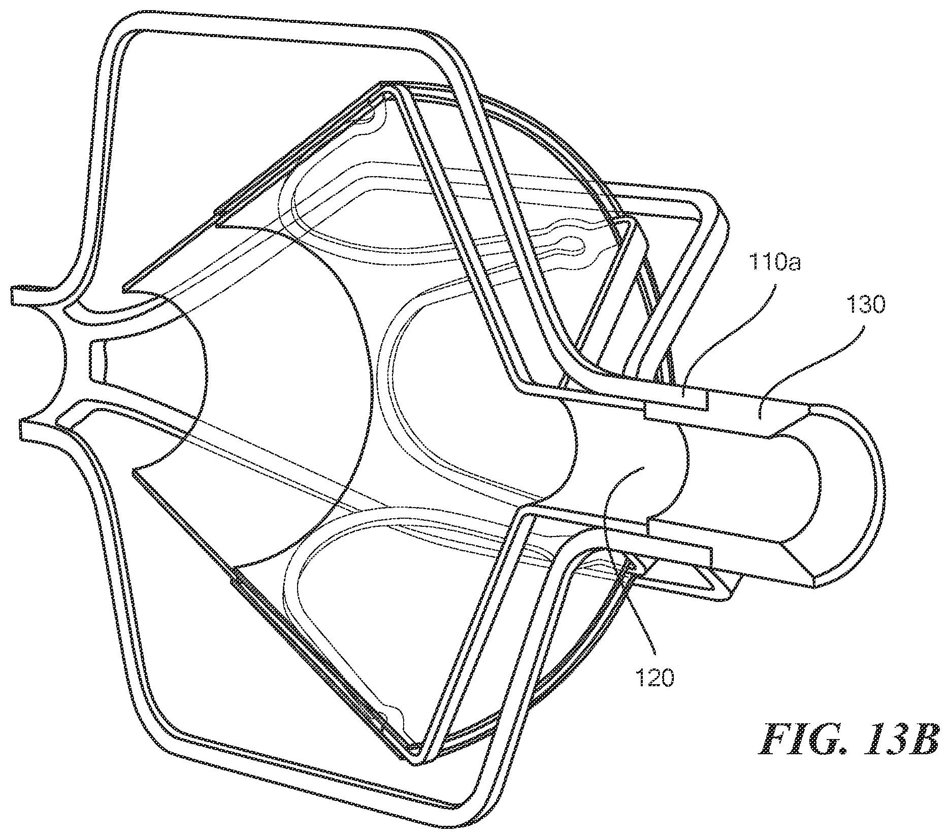 Patent US12588909 Figure 17 – Transcatheter device and minimally invasive method for constricting and adjusting blood flow through a blood vessel