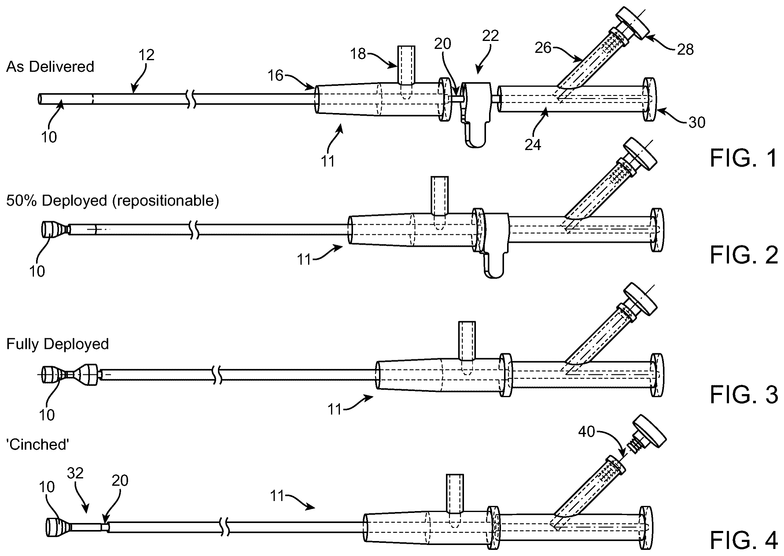 Patent US12588910 Figure 1 – Vascular flow restriction devices and related systems and methods