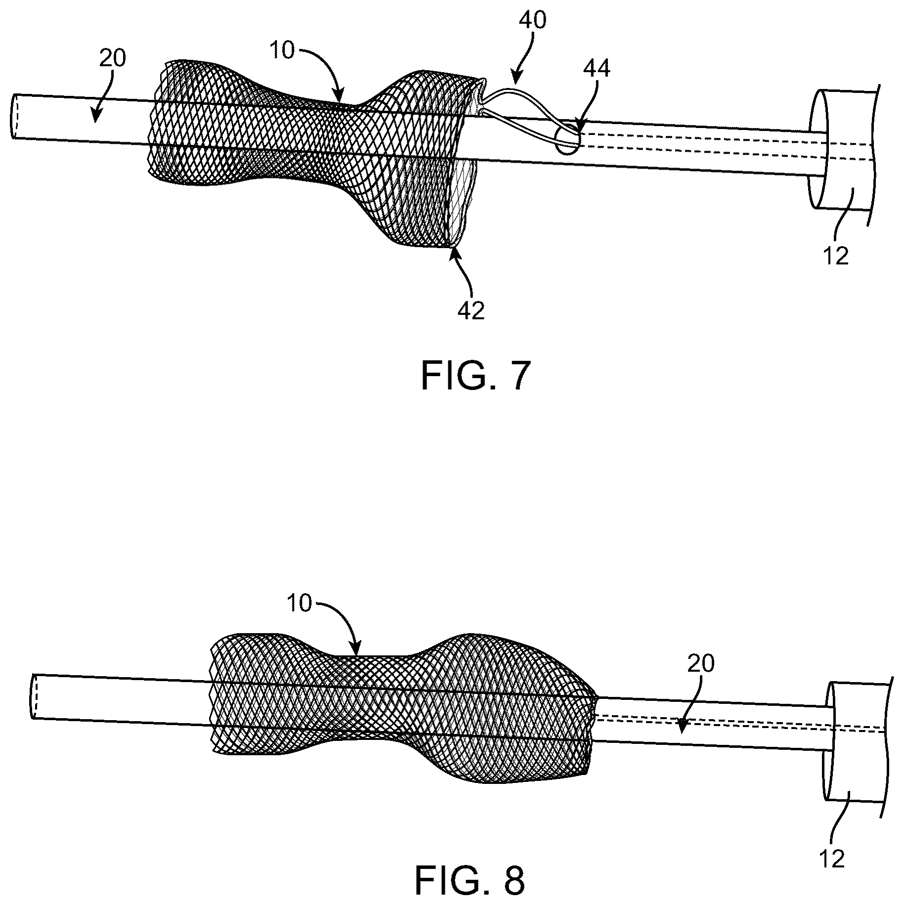Patent US12588910 Figure 3 – Vascular flow restriction devices and related systems and methods