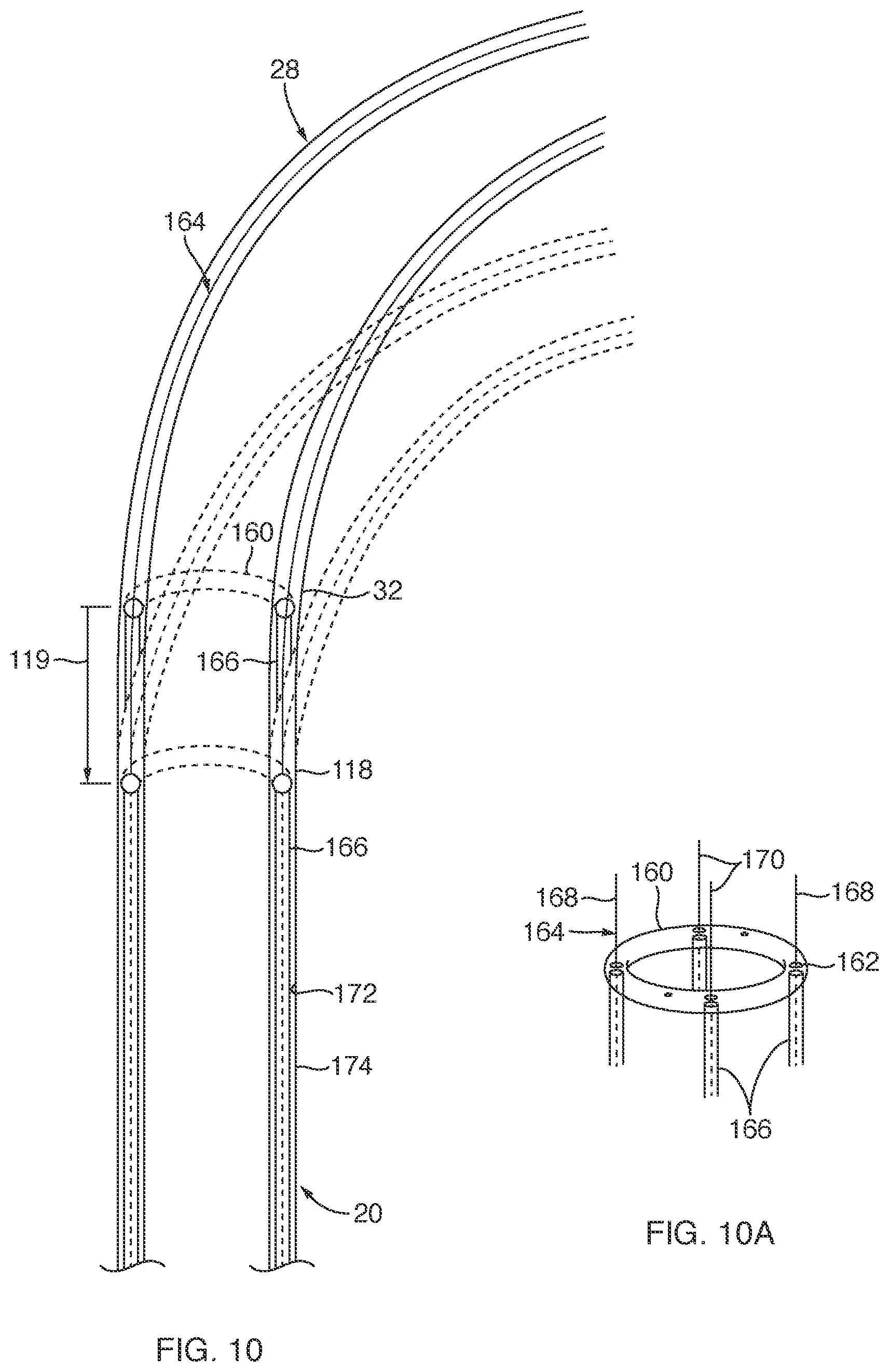 Patent US12588911 Figure 7 – Deflectable sheath for left atrial appendage device, system, and method thereof