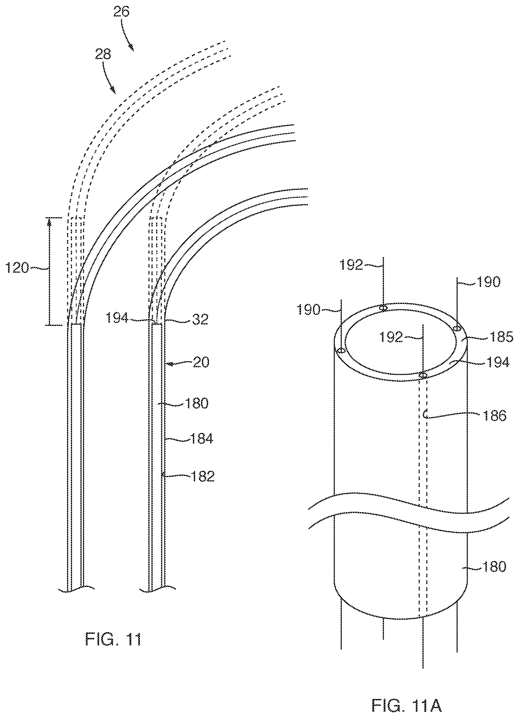 Patent US12588911 Figure 8 – Deflectable sheath for left atrial appendage device, system, and method thereof