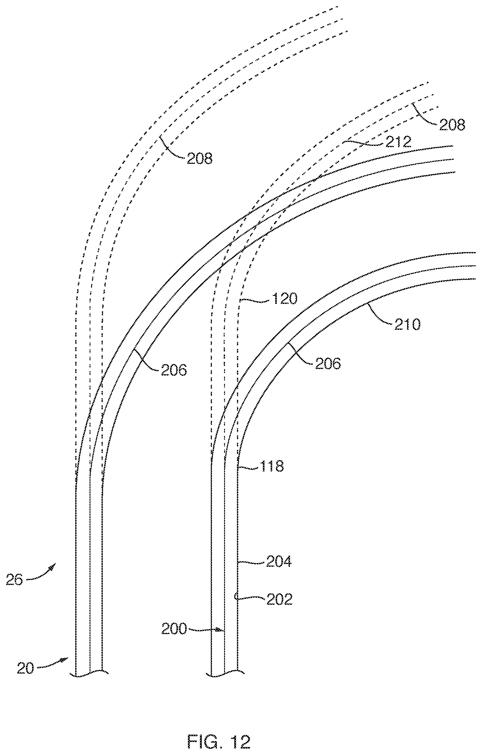 Patent US12588911 Figure 9 – Deflectable sheath for left atrial appendage device, system, and method thereof