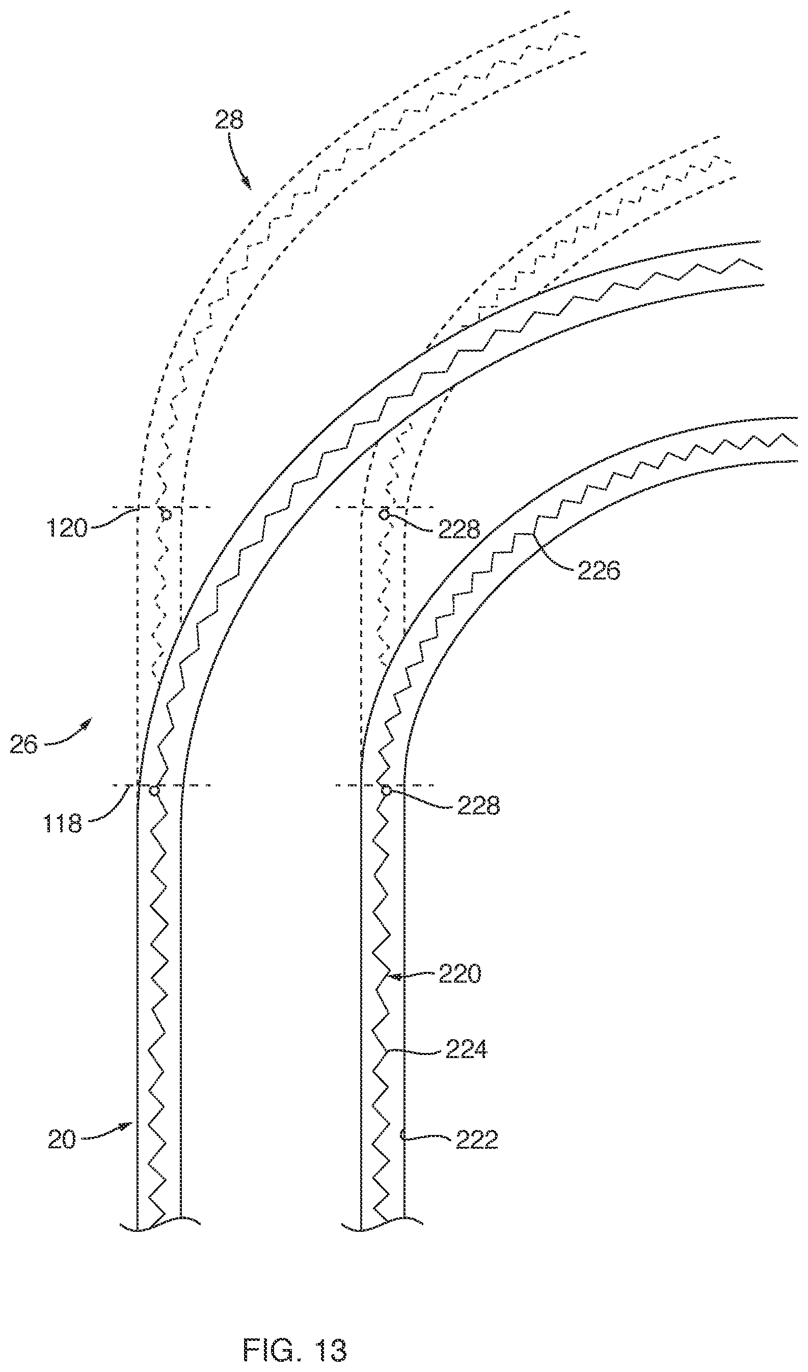 Patent US12588911 Figure 10 – Deflectable sheath for left atrial appendage device, system, and method thereof