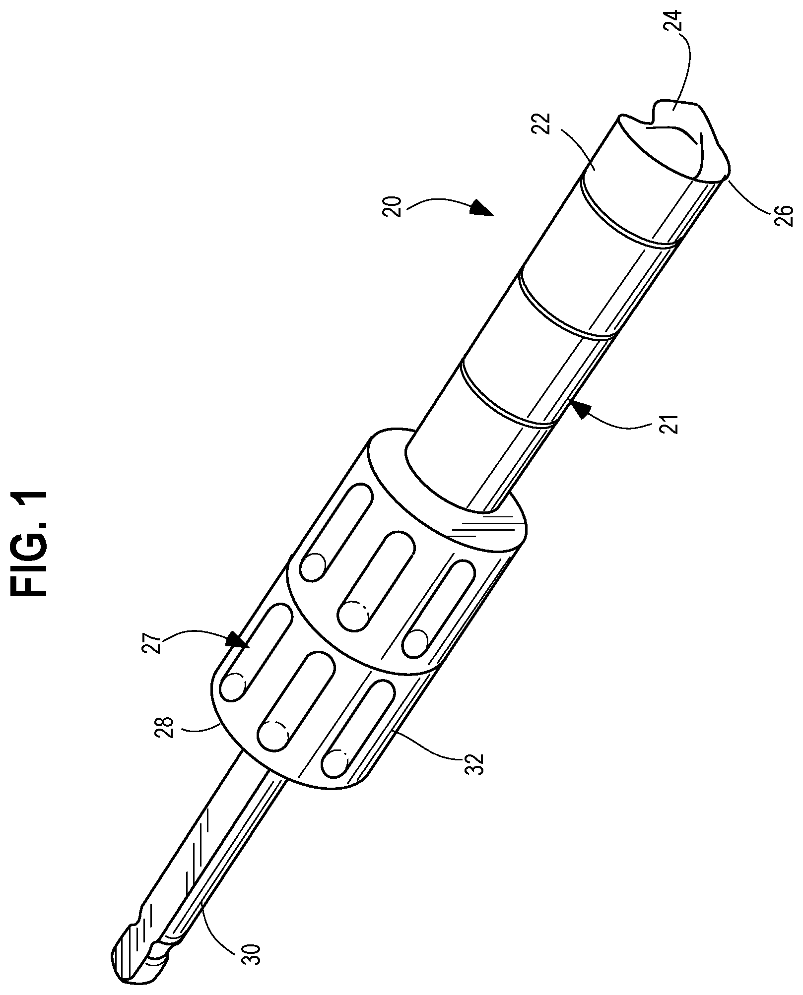 Patent US12588913 — Bone graft harvesting apparatus — Figure 1