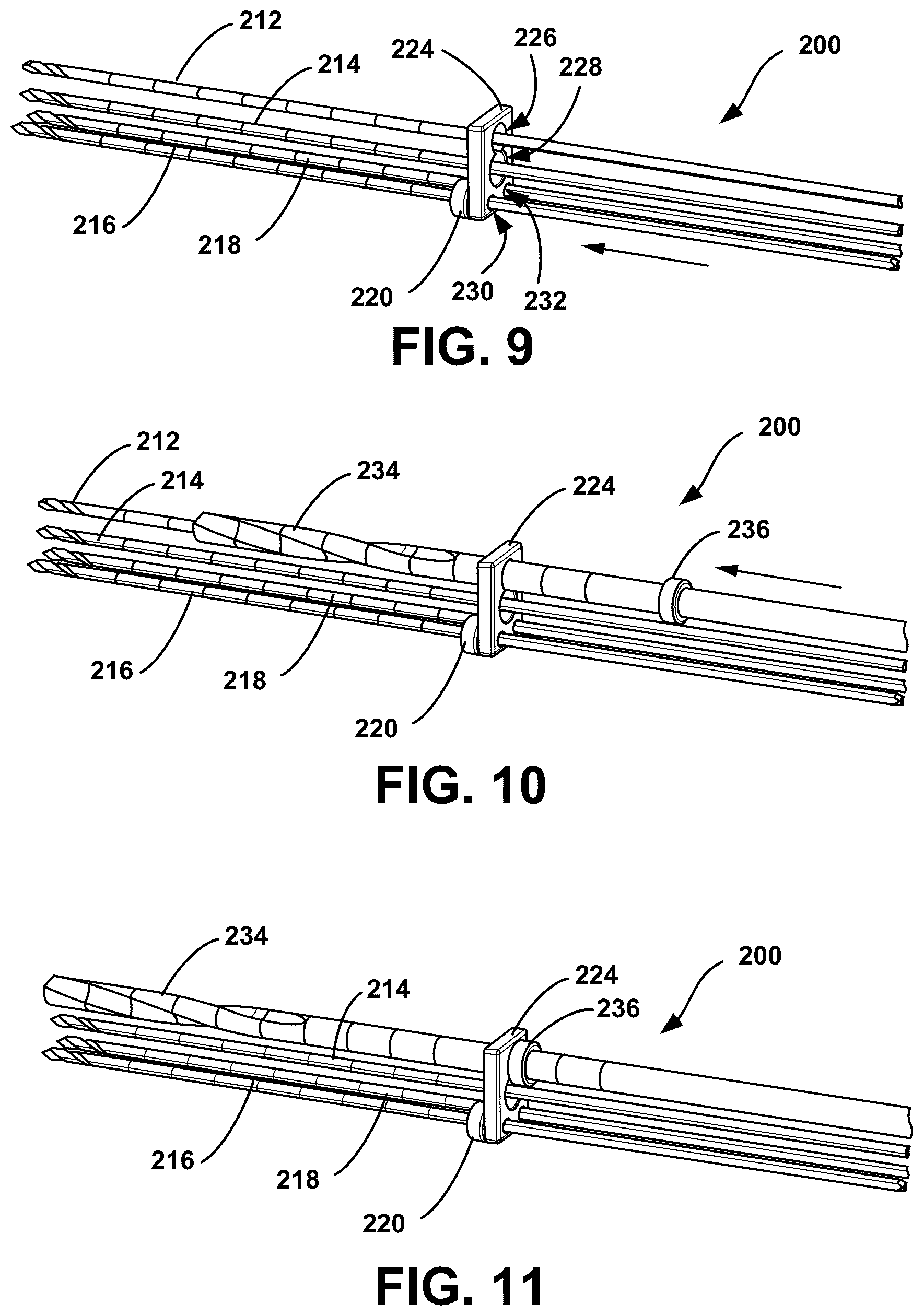 Patent US12588914 Figure 4 – Meniscal allograft transplantation system and methods for use