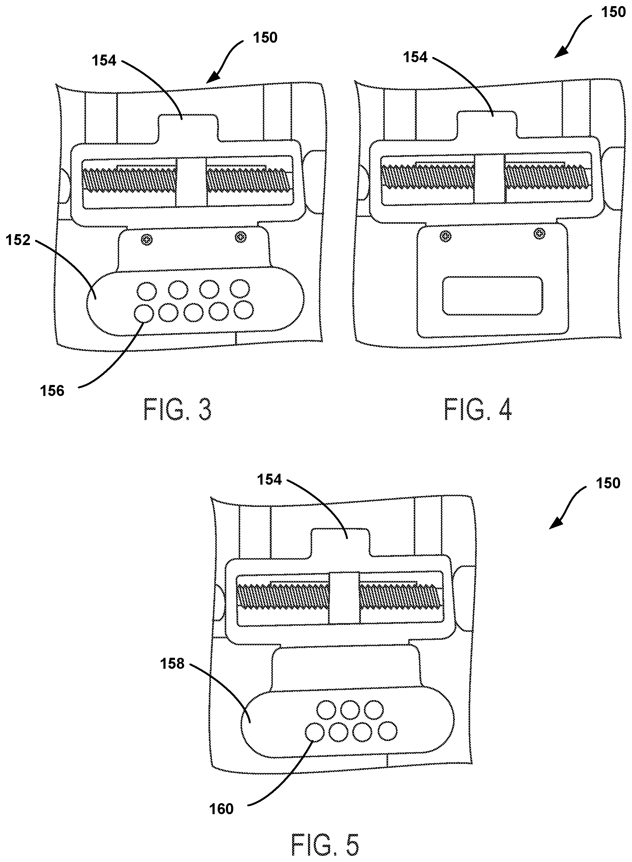 Patent US12588915 Figure 2 – Bone resection method by plunge milling and rasping during total ankle arthroplasty
