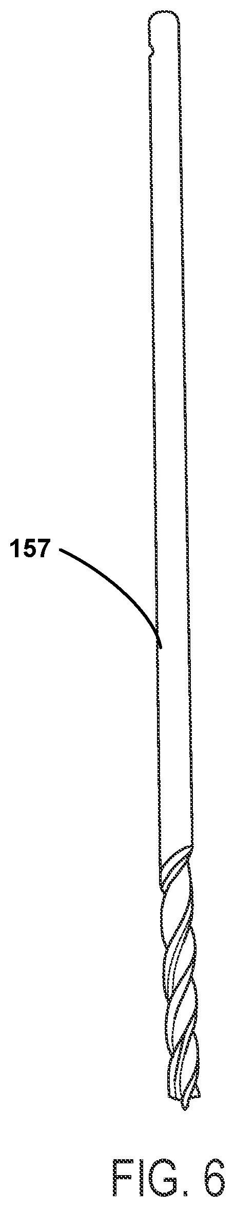 Patent US12588915 Figure 3 – Bone resection method by plunge milling and rasping during total ankle arthroplasty