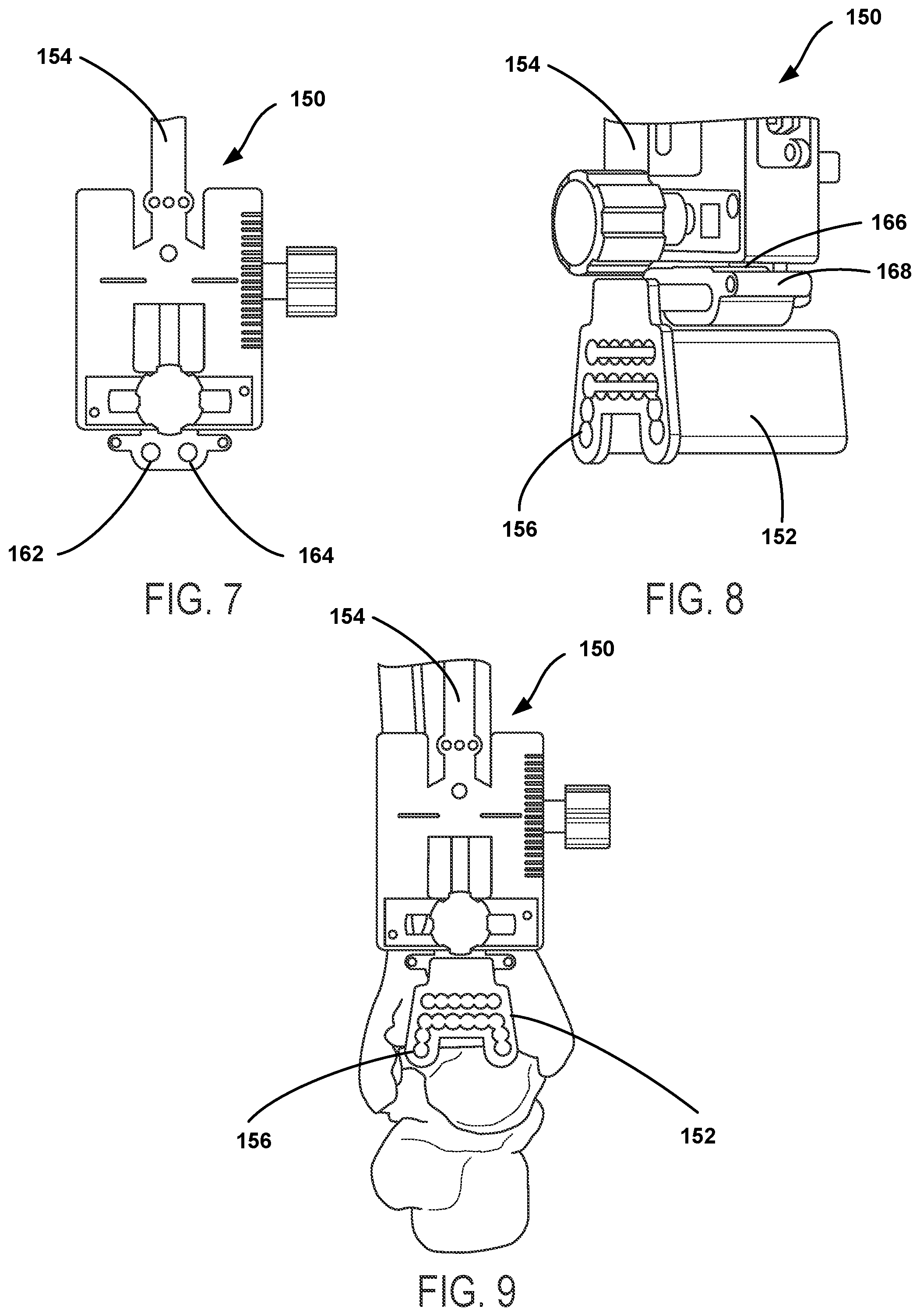 Patent US12588915 Figure 4 – Bone resection method by plunge milling and rasping during total ankle arthroplasty