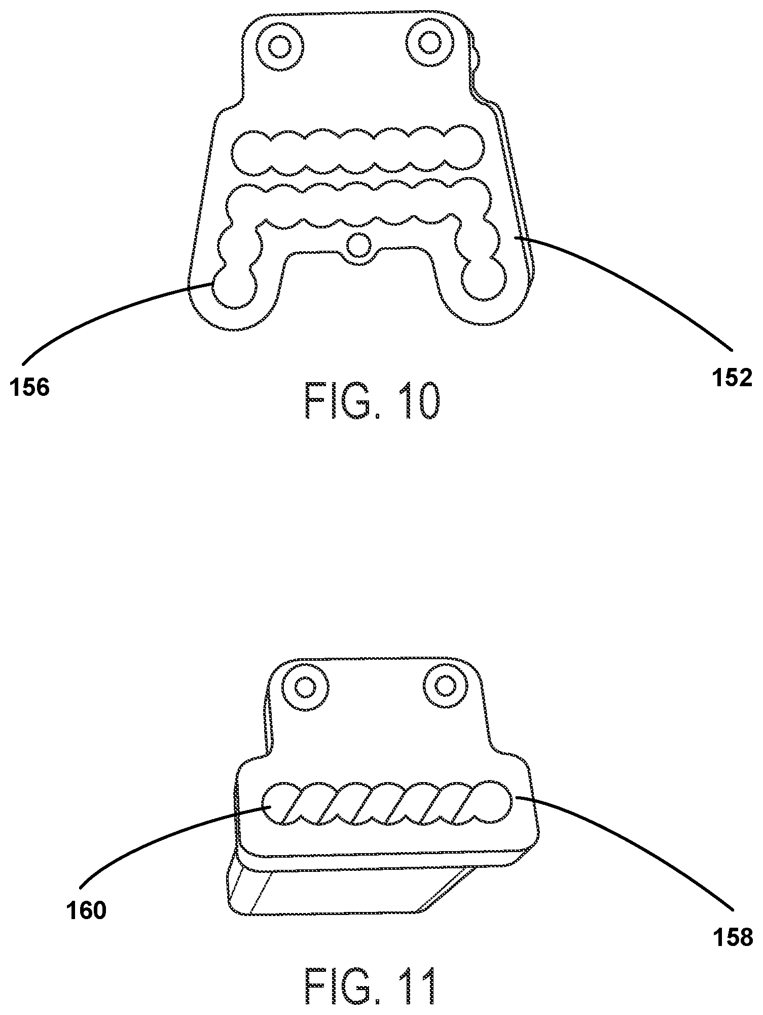 Patent US12588915 Figure 5 – Bone resection method by plunge milling and rasping during total ankle arthroplasty
