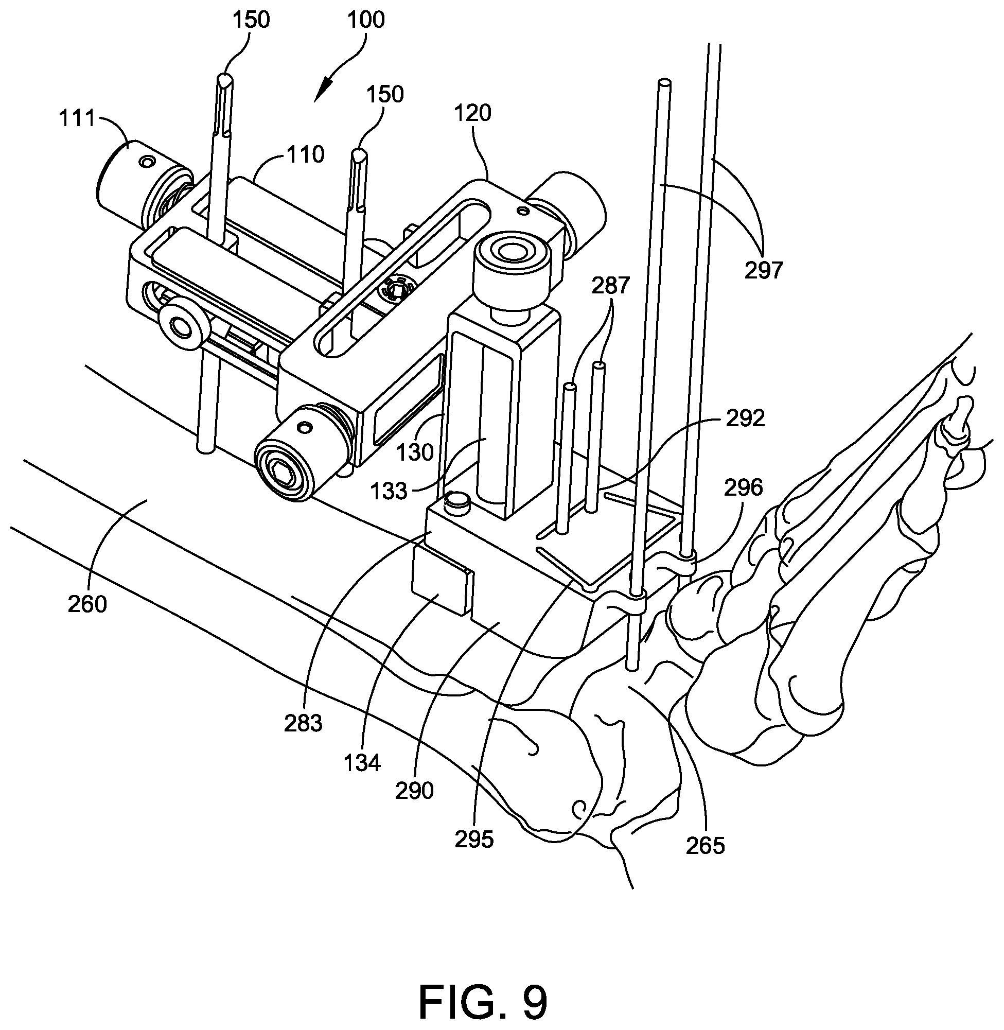 Patent US12588916 Figure 7 – Ankle replacement system and method