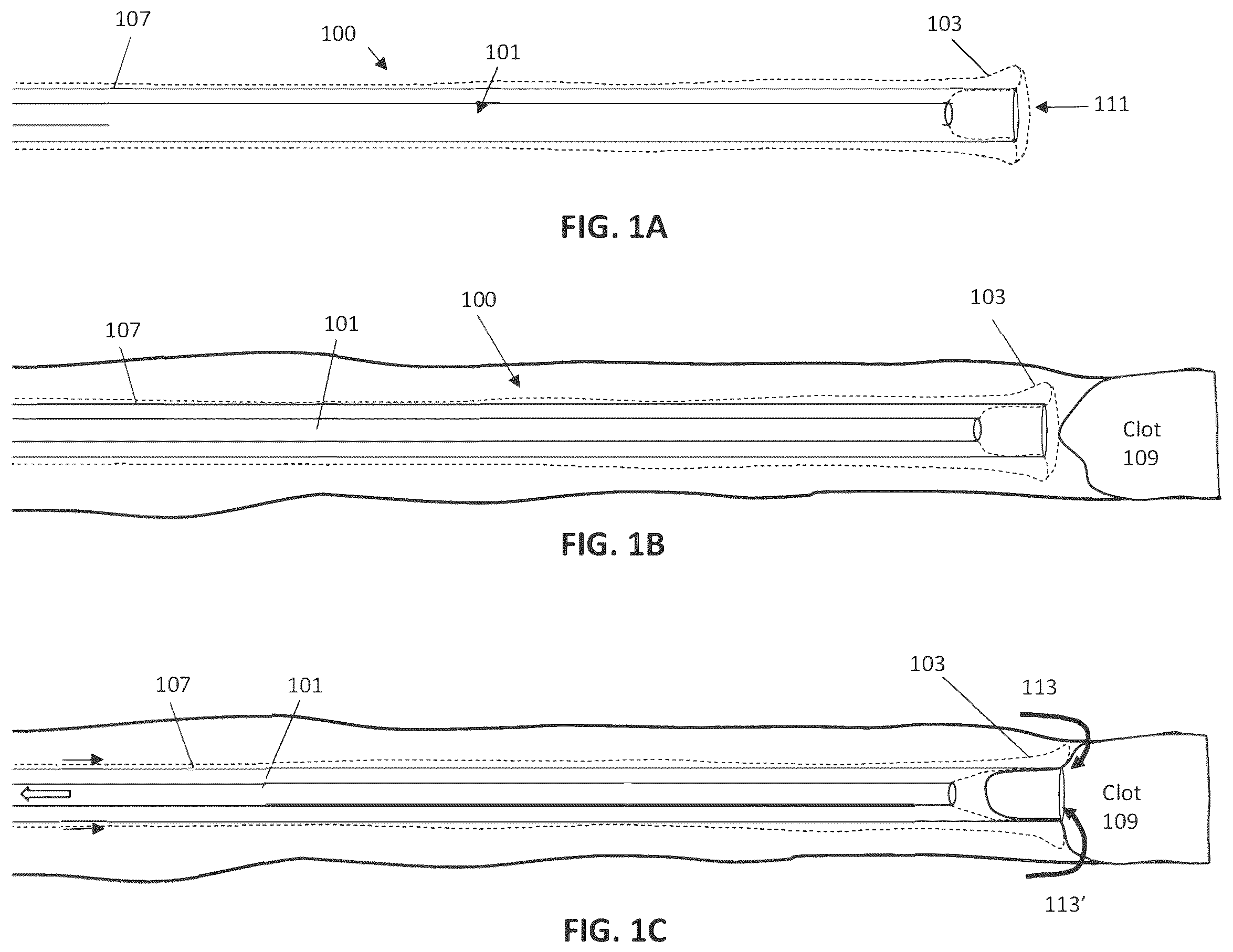 Patent US12588918 Figure 1 – Inverting capture apparatuses having material depots