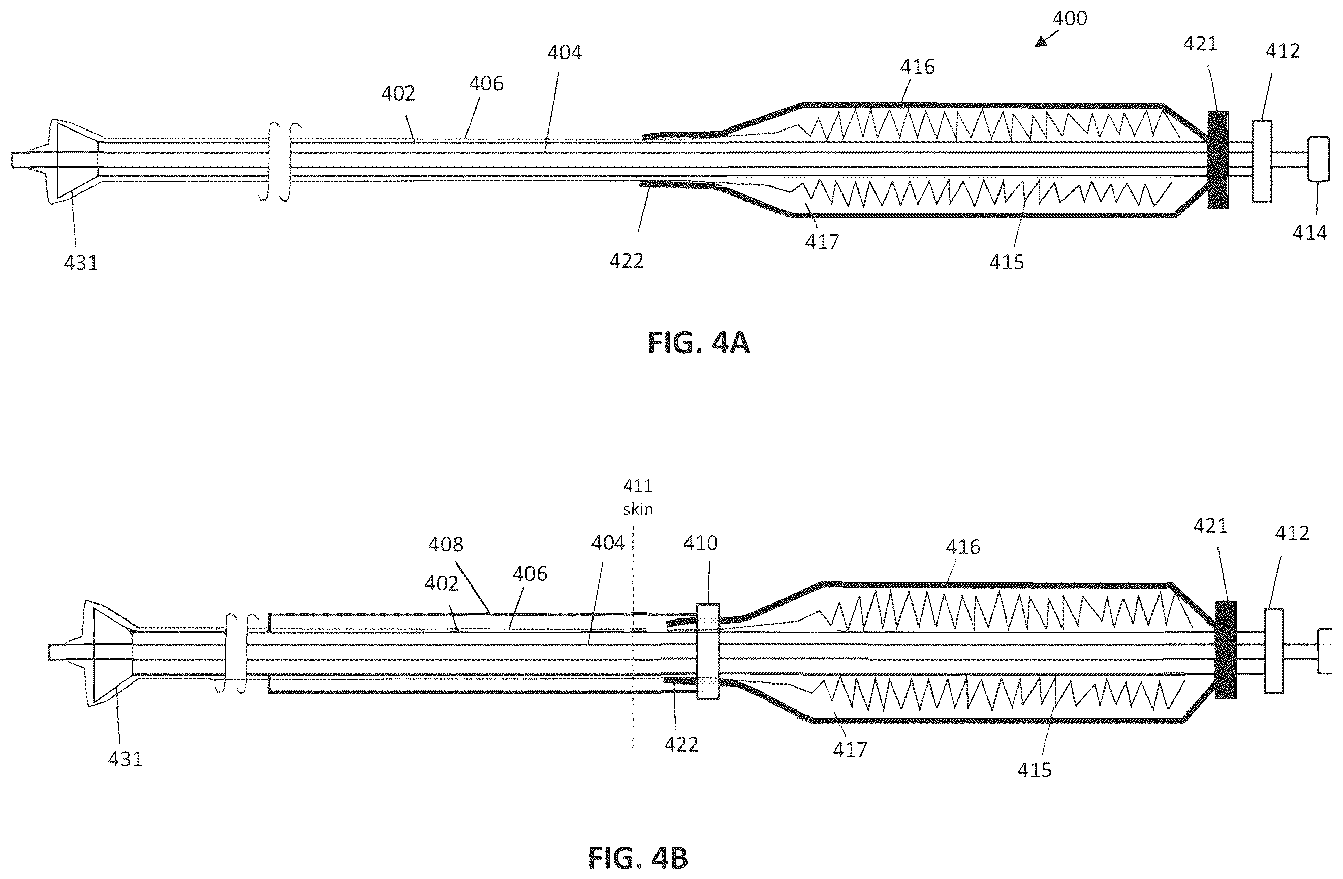 Patent US12588918 Figure 4 – Inverting capture apparatuses having material depots