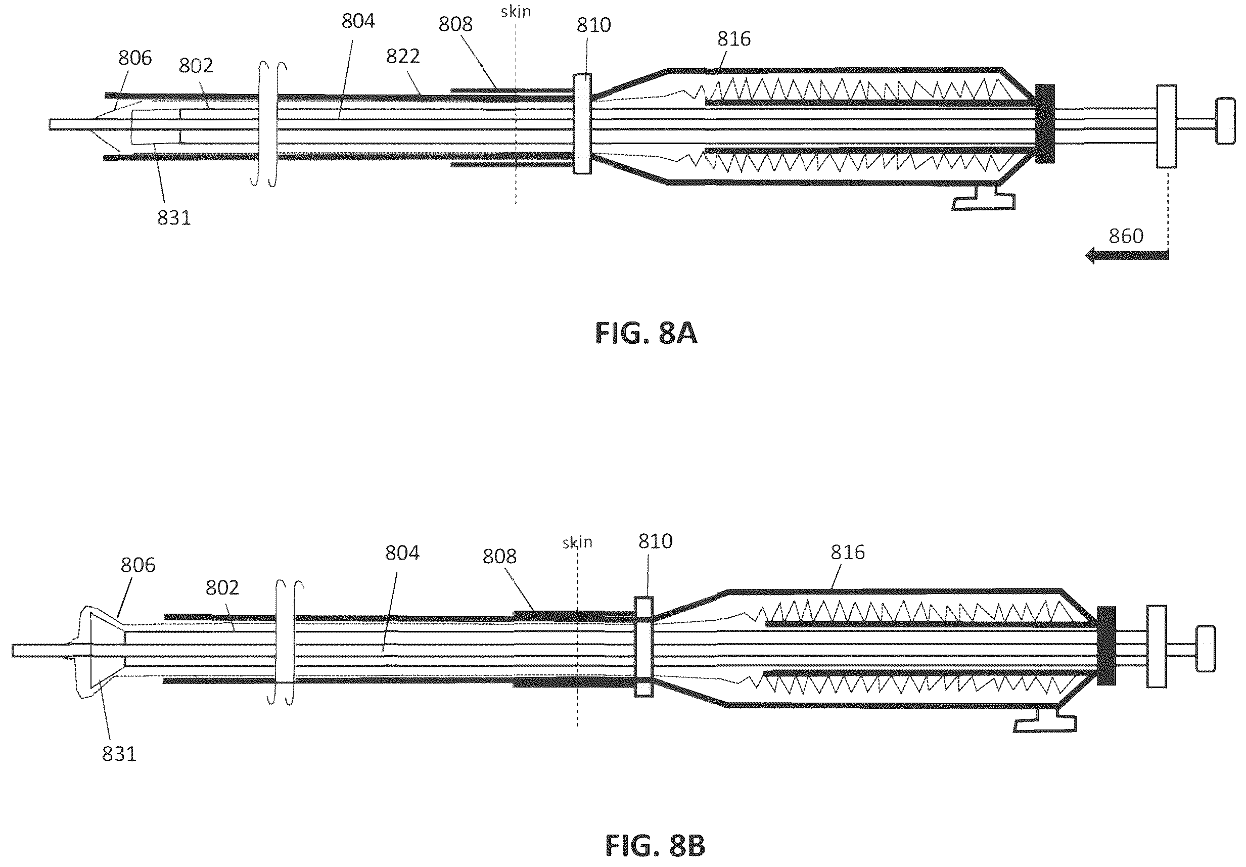 Patent US12588918 Figure 8 – Inverting capture apparatuses having material depots