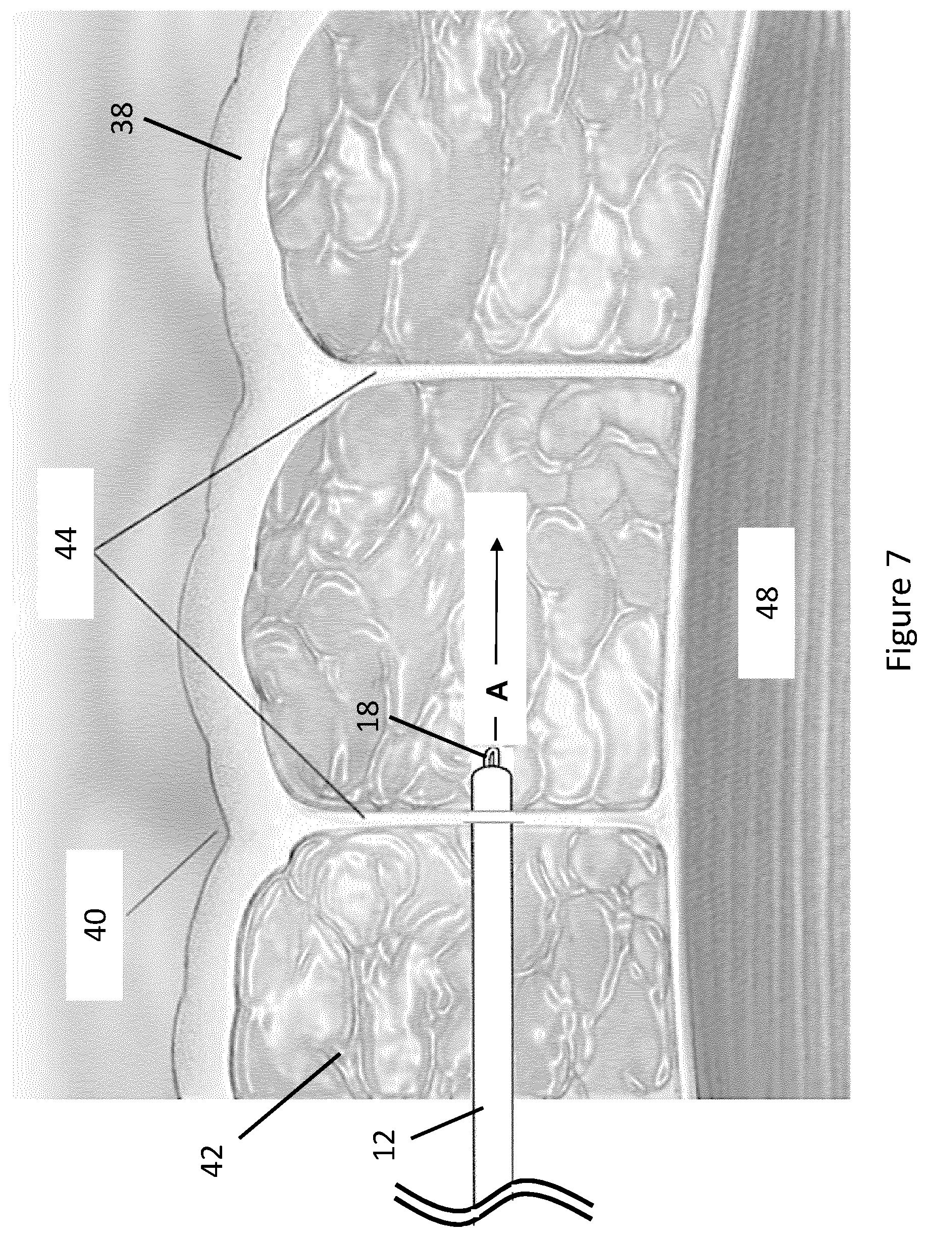 Patent US12588923 Figure 7 – Device for performing a cosmetic or medical procedure