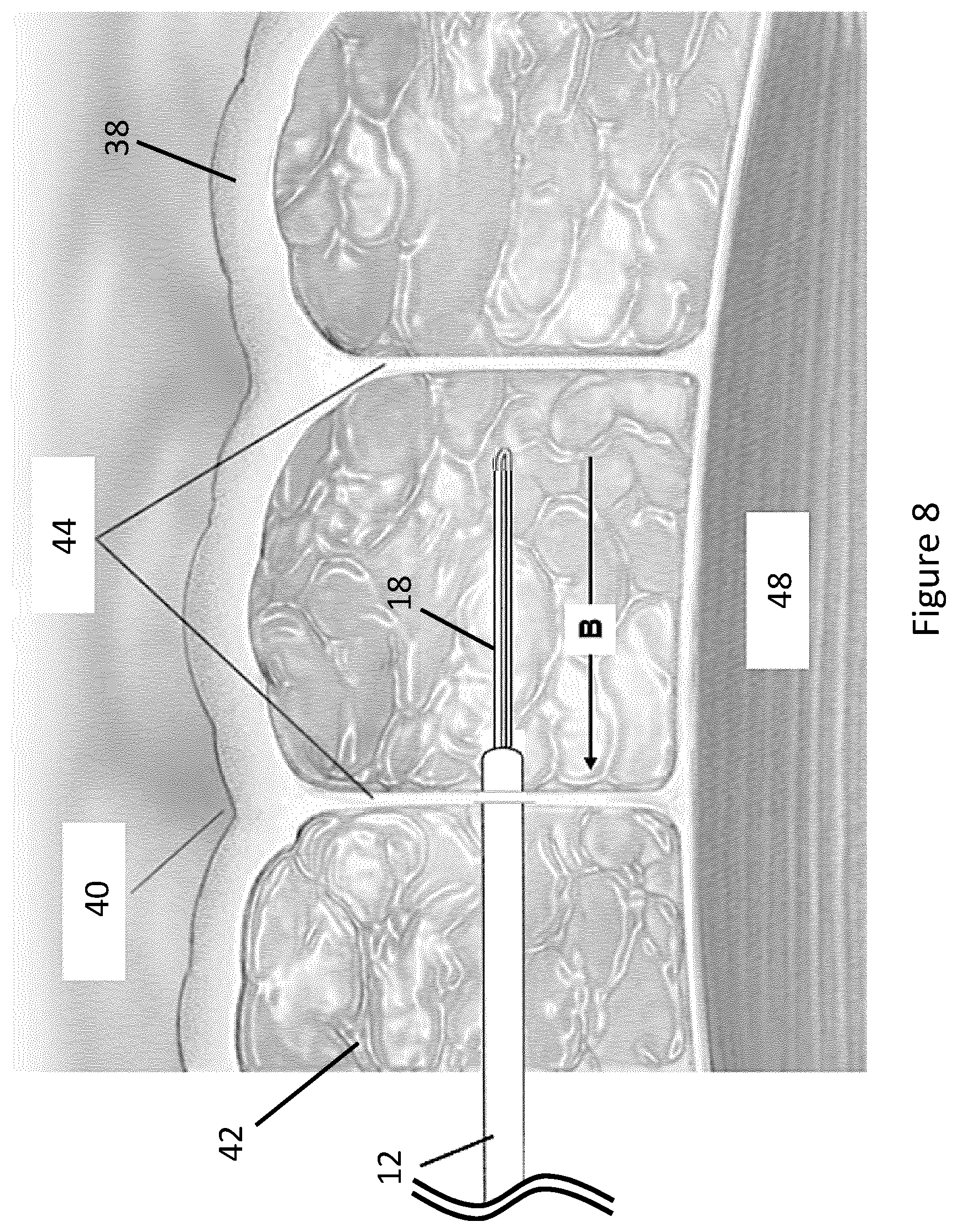 Patent US12588923 Figure 8 – Device for performing a cosmetic or medical procedure