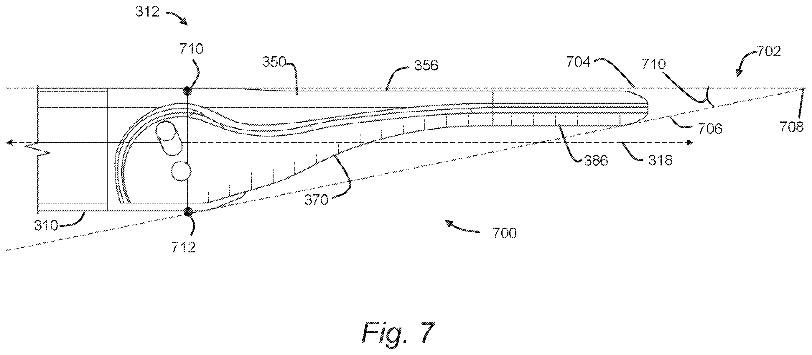Patent US12588924 Figure 5 – Minimally invasive dissector for inter-layer procedures