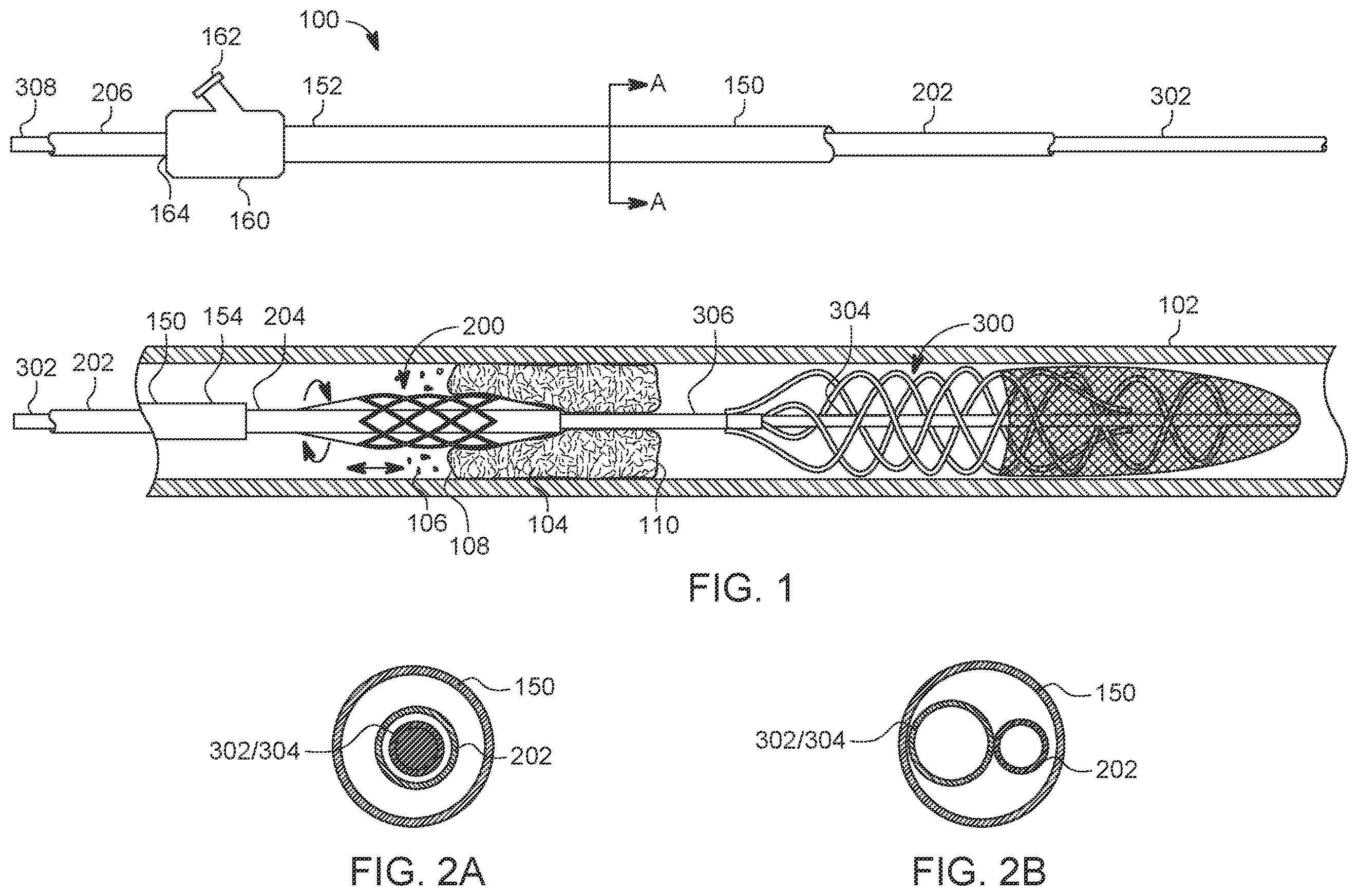 Patent US12588925 Figure 1 – Deep vein thrombosis thrombectomy device with embolic protection