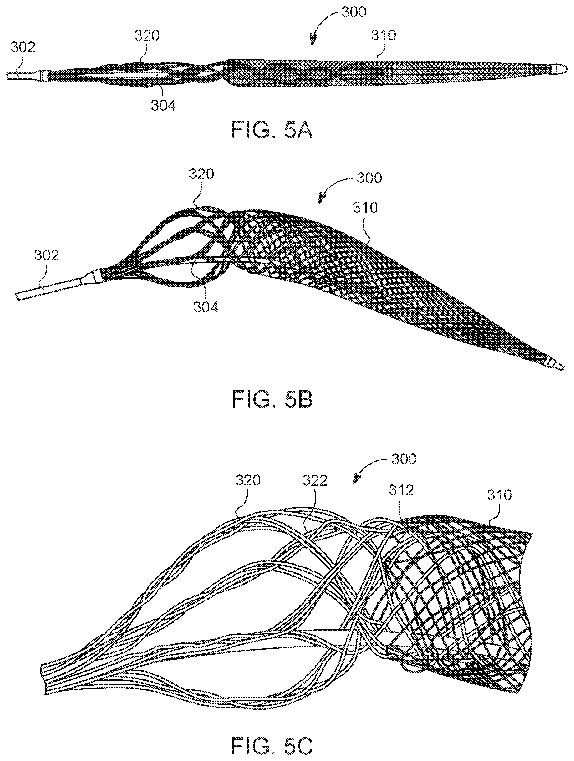 Patent US12588925 Figure 5 – Deep vein thrombosis thrombectomy device with embolic protection