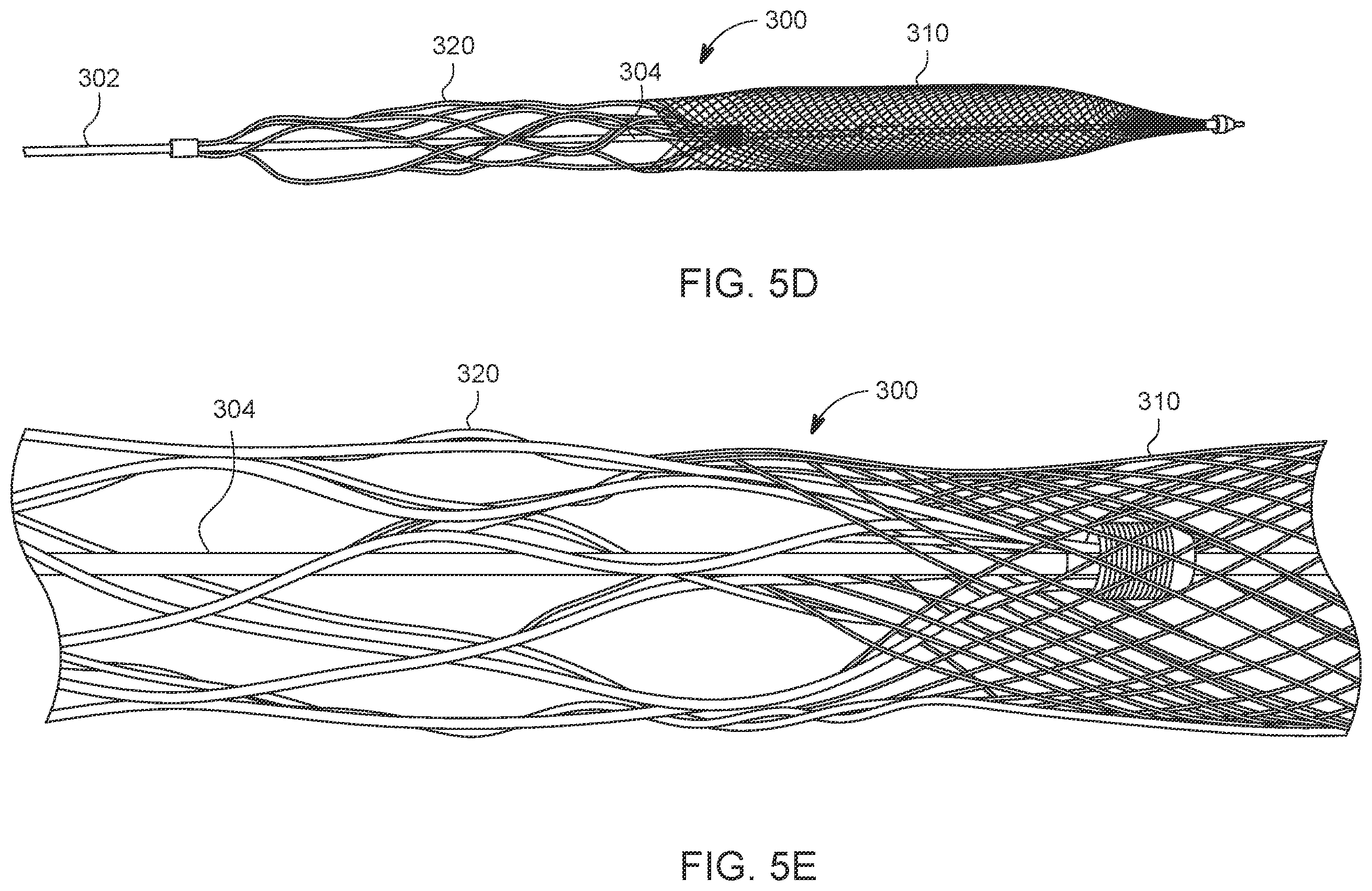 Patent US12588925 Figure 6 – Deep vein thrombosis thrombectomy device with embolic protection