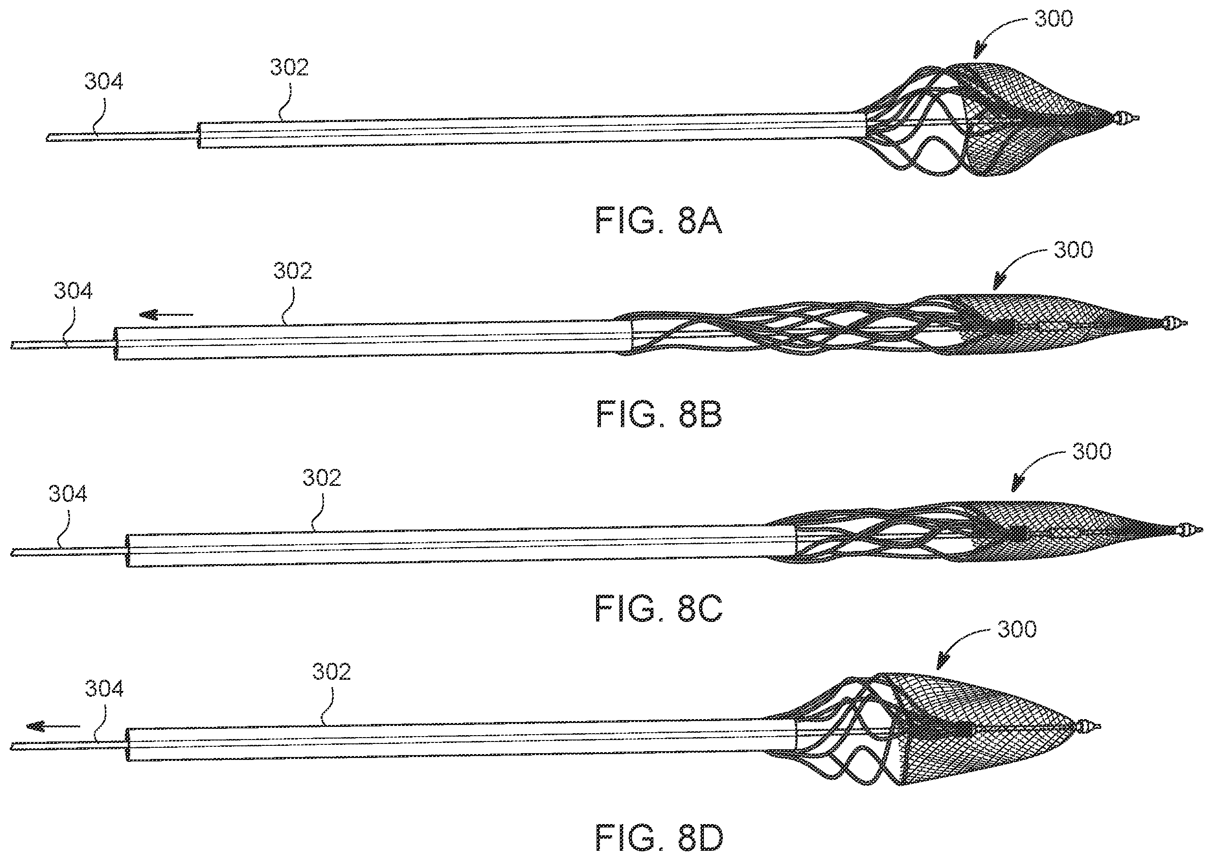 Patent US12588925 Figure 9 – Deep vein thrombosis thrombectomy device with embolic protection