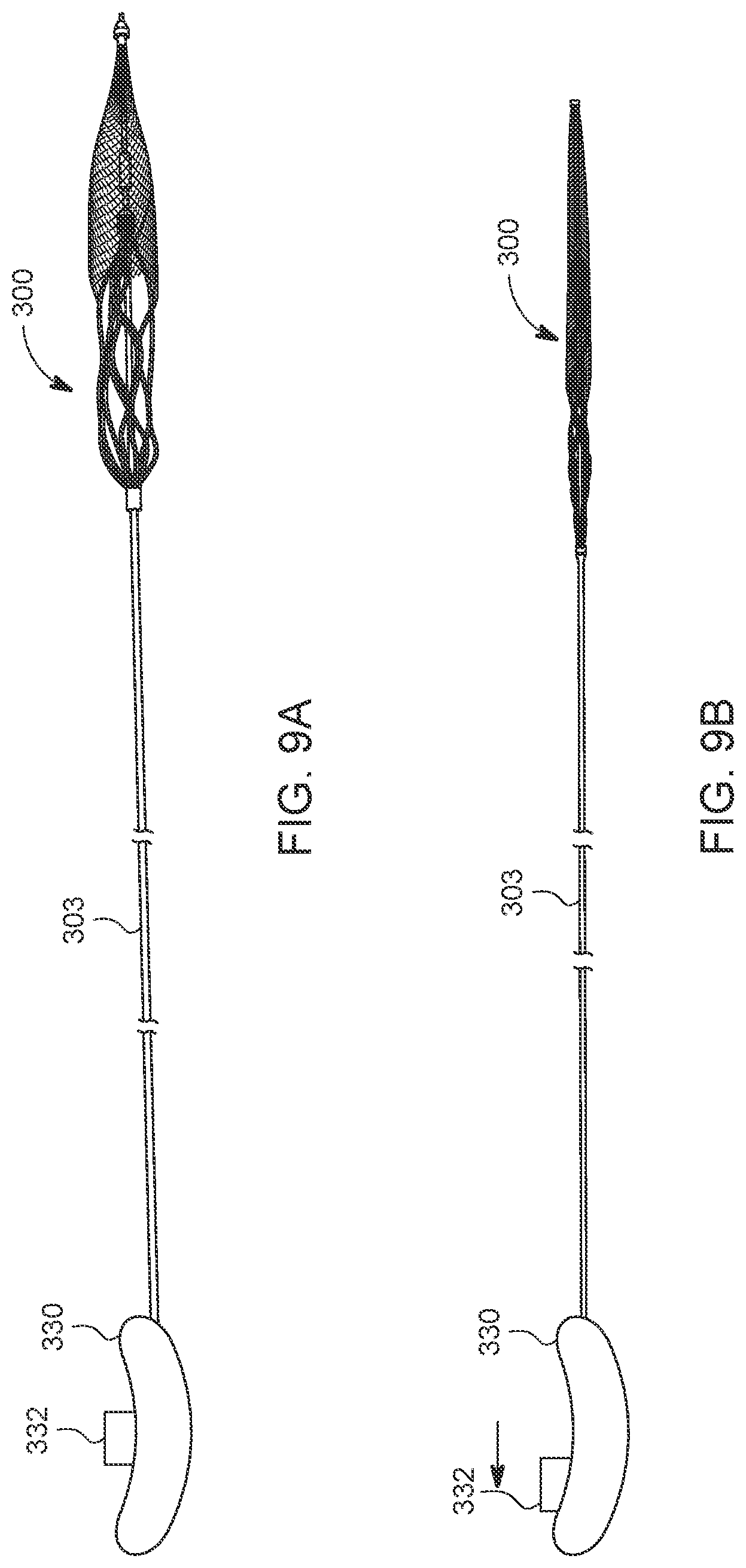 Patent US12588925 Figure 10 – Deep vein thrombosis thrombectomy device with embolic protection