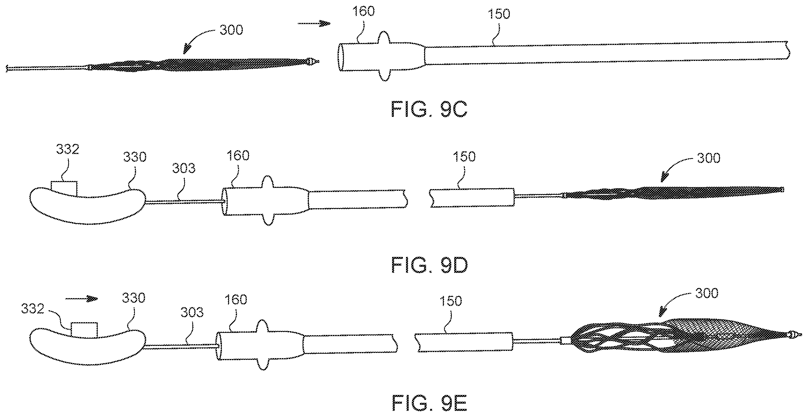 Patent US12588925 Figure 11 – Deep vein thrombosis thrombectomy device with embolic protection