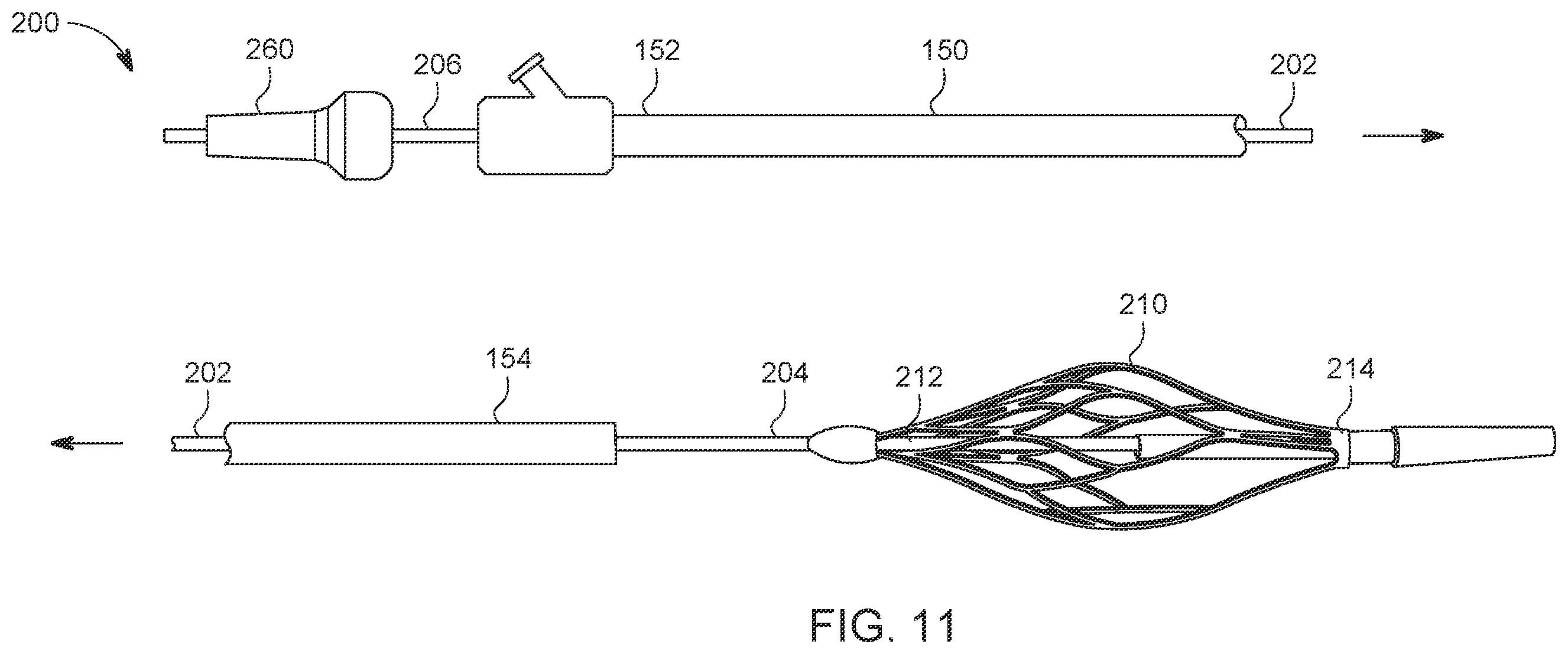 Patent US12588925 Figure 14 – Deep vein thrombosis thrombectomy device with embolic protection