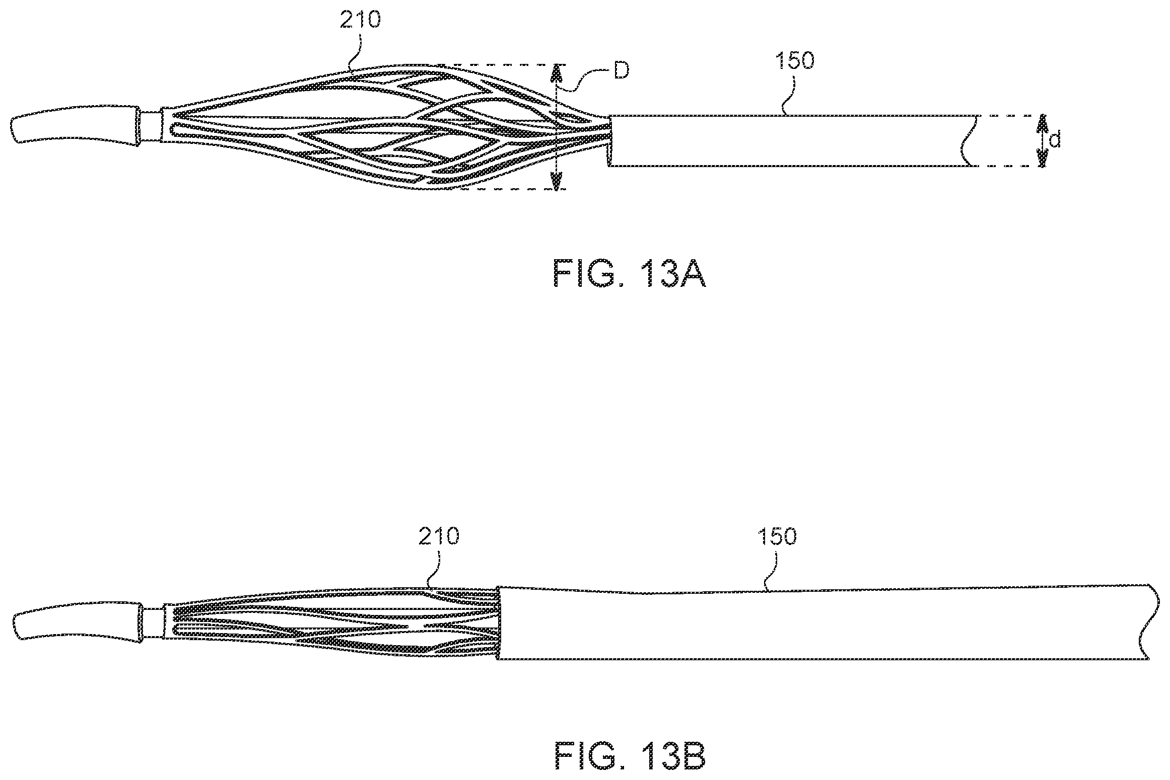 Patent US12588925 Figure 16 – Deep vein thrombosis thrombectomy device with embolic protection