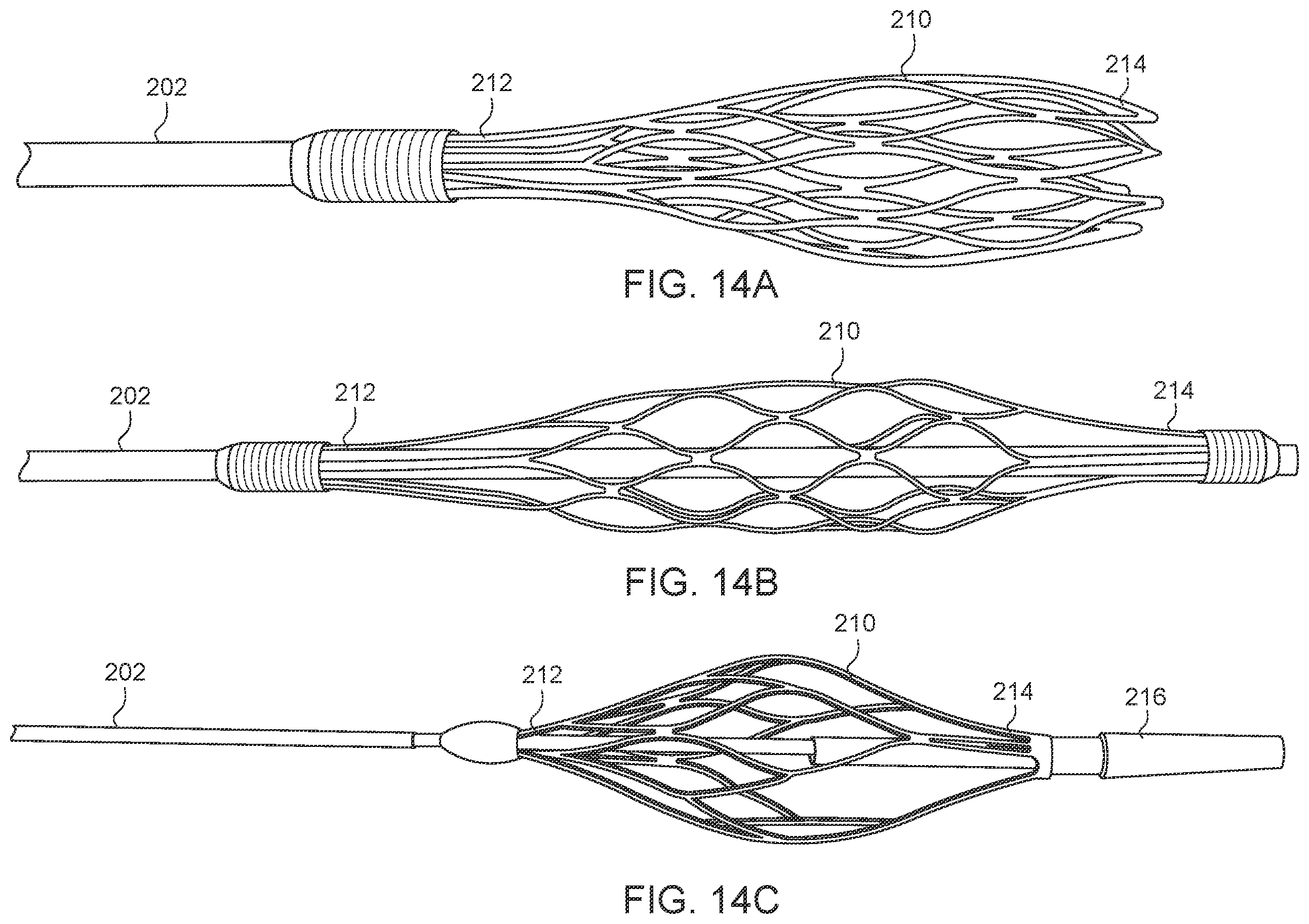Patent US12588925 Figure 17 – Deep vein thrombosis thrombectomy device with embolic protection