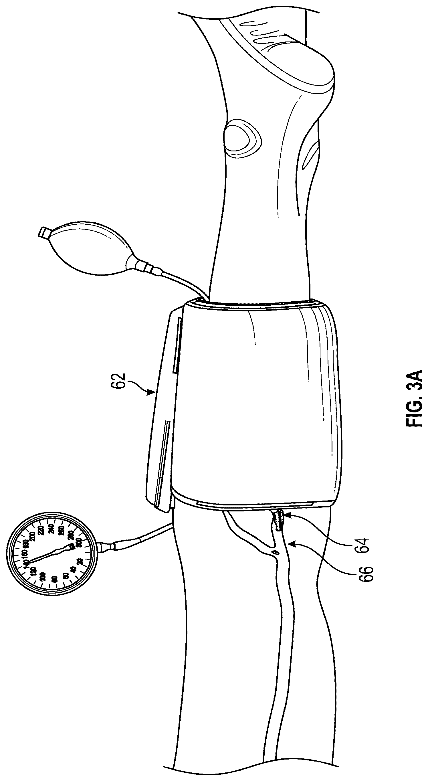 Patent US12588926 Figure 3 – Devices and methods for removal of material in a vasculature
