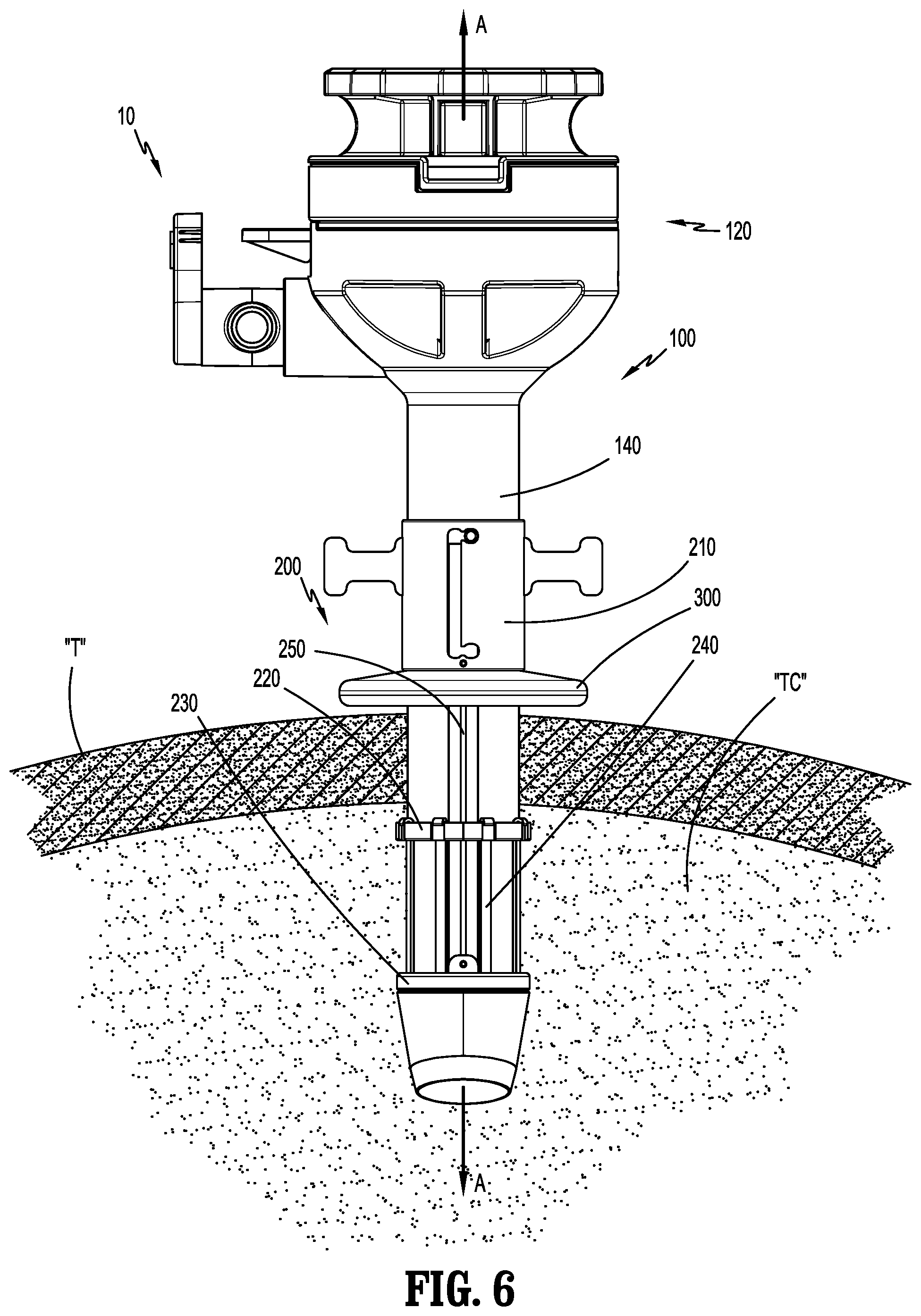 Patent US12588927 Figure 6 – Surgical access device with fixation mechanism