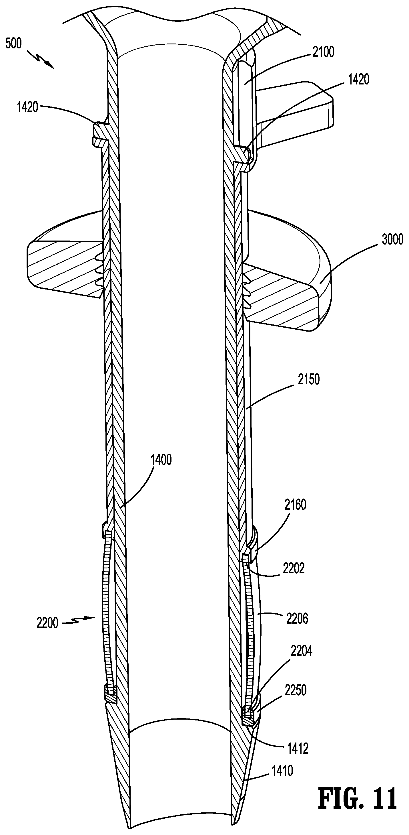Patent US12588927 Figure 11 – Surgical access device with fixation mechanism