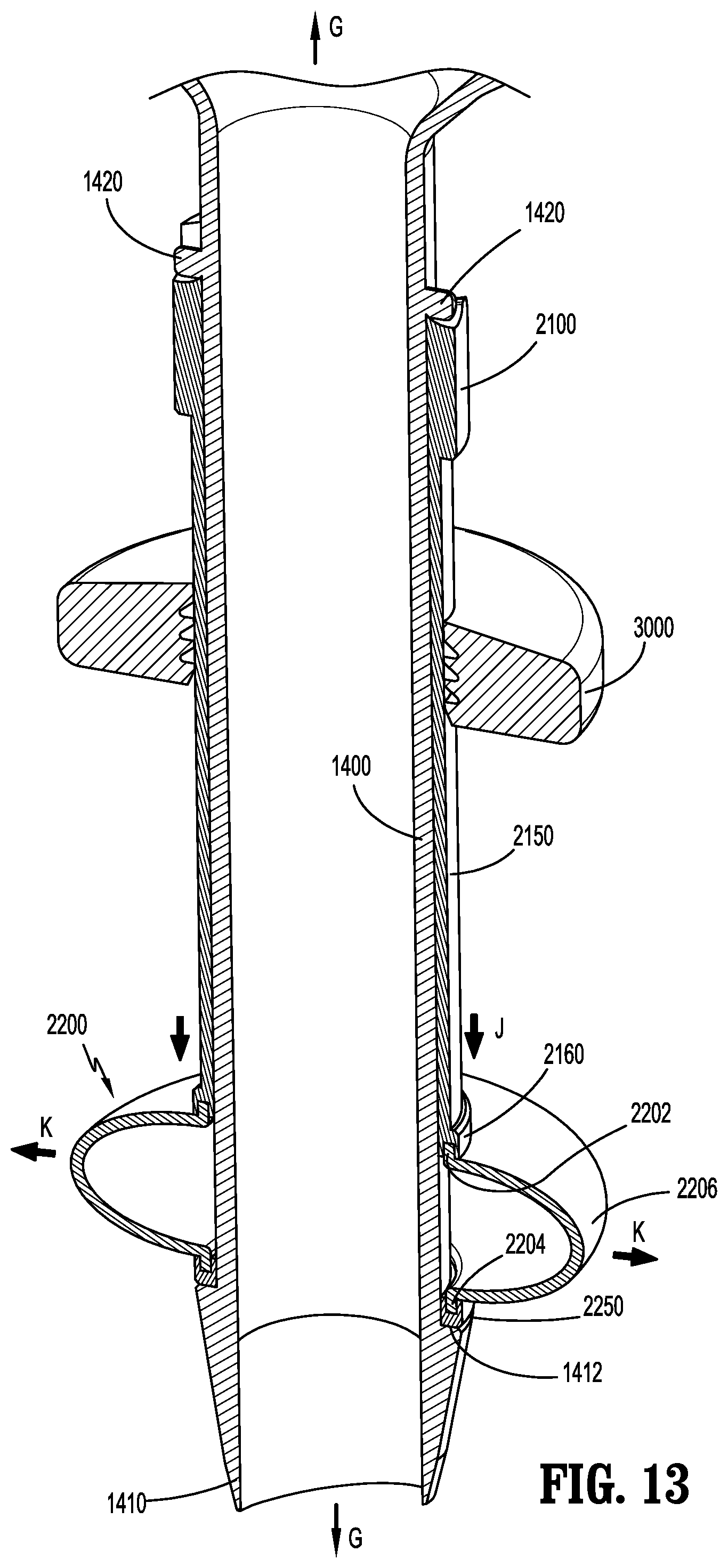 Patent US12588927 Figure 13 – Surgical access device with fixation mechanism