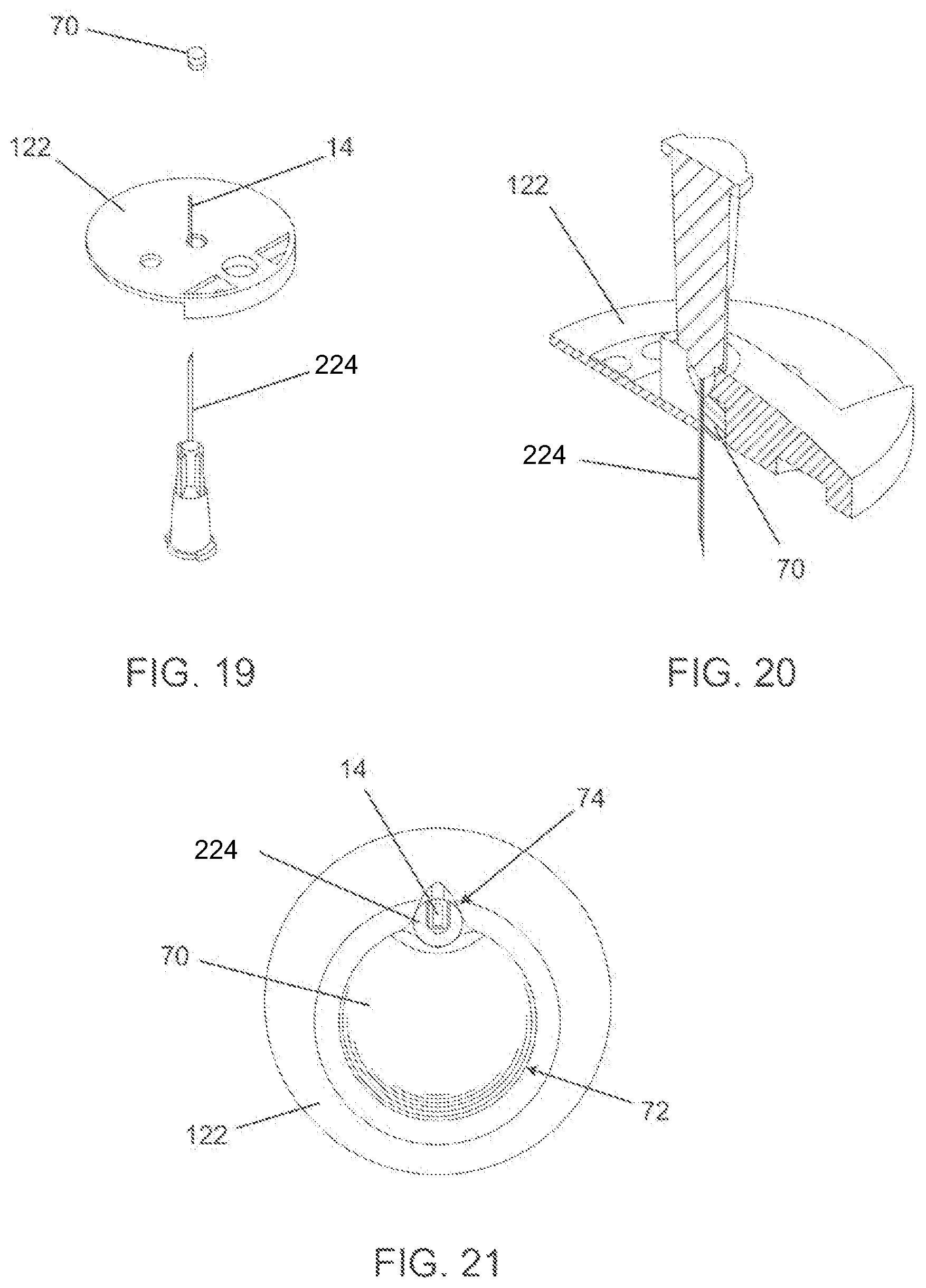 Patent US12588928 Figure 17 – Medical device inserters and processes of inserting and using medical devices