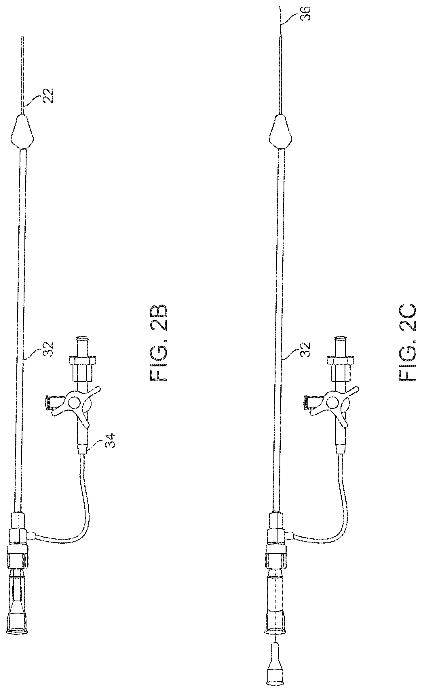 Patent US12588929 Figure 3 – Apparatus and method for everting catheter for embryo transfer using transvaginal ultrasound