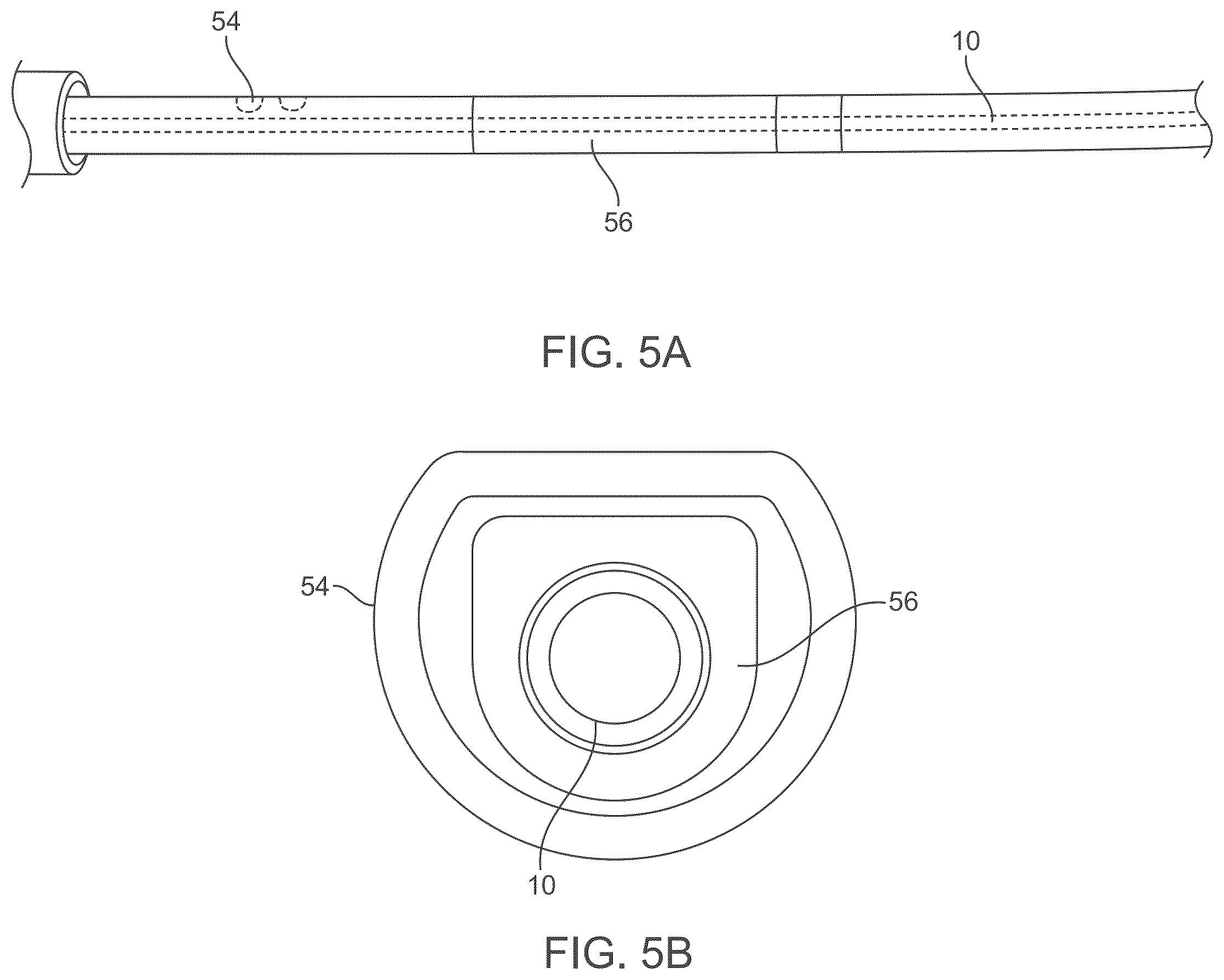 Patent US12588929 Figure 6 – Apparatus and method for everting catheter for embryo transfer using transvaginal ultrasound