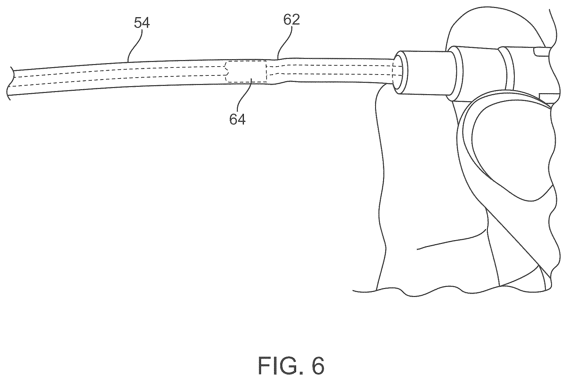 Patent US12588929 Figure 8 – Apparatus and method for everting catheter for embryo transfer using transvaginal ultrasound