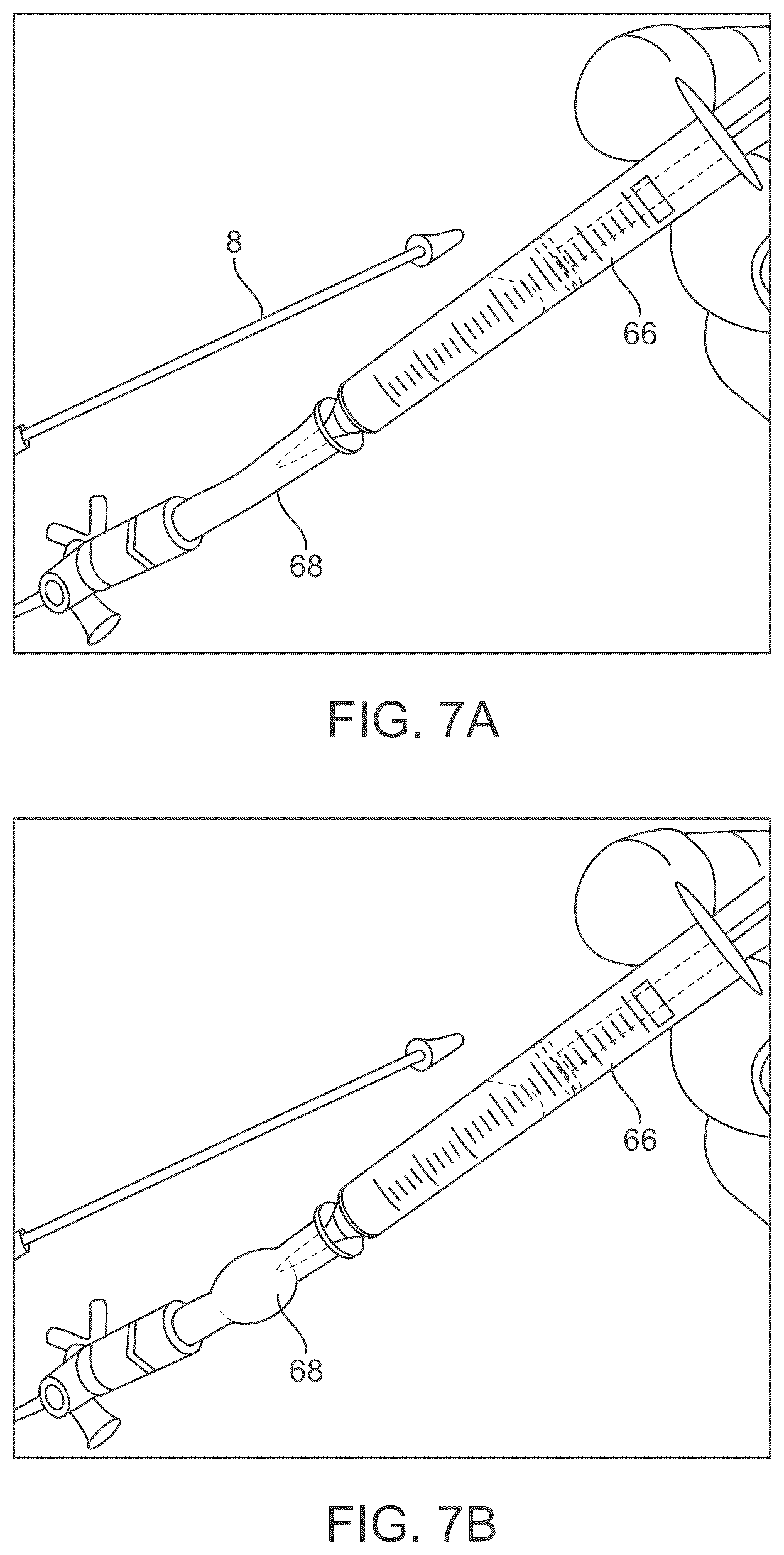 Patent US12588929 Figure 9 – Apparatus and method for everting catheter for embryo transfer using transvaginal ultrasound