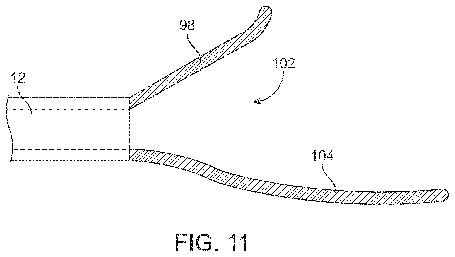 Patent US12588929 Figure 14 – Apparatus and method for everting catheter for embryo transfer using transvaginal ultrasound