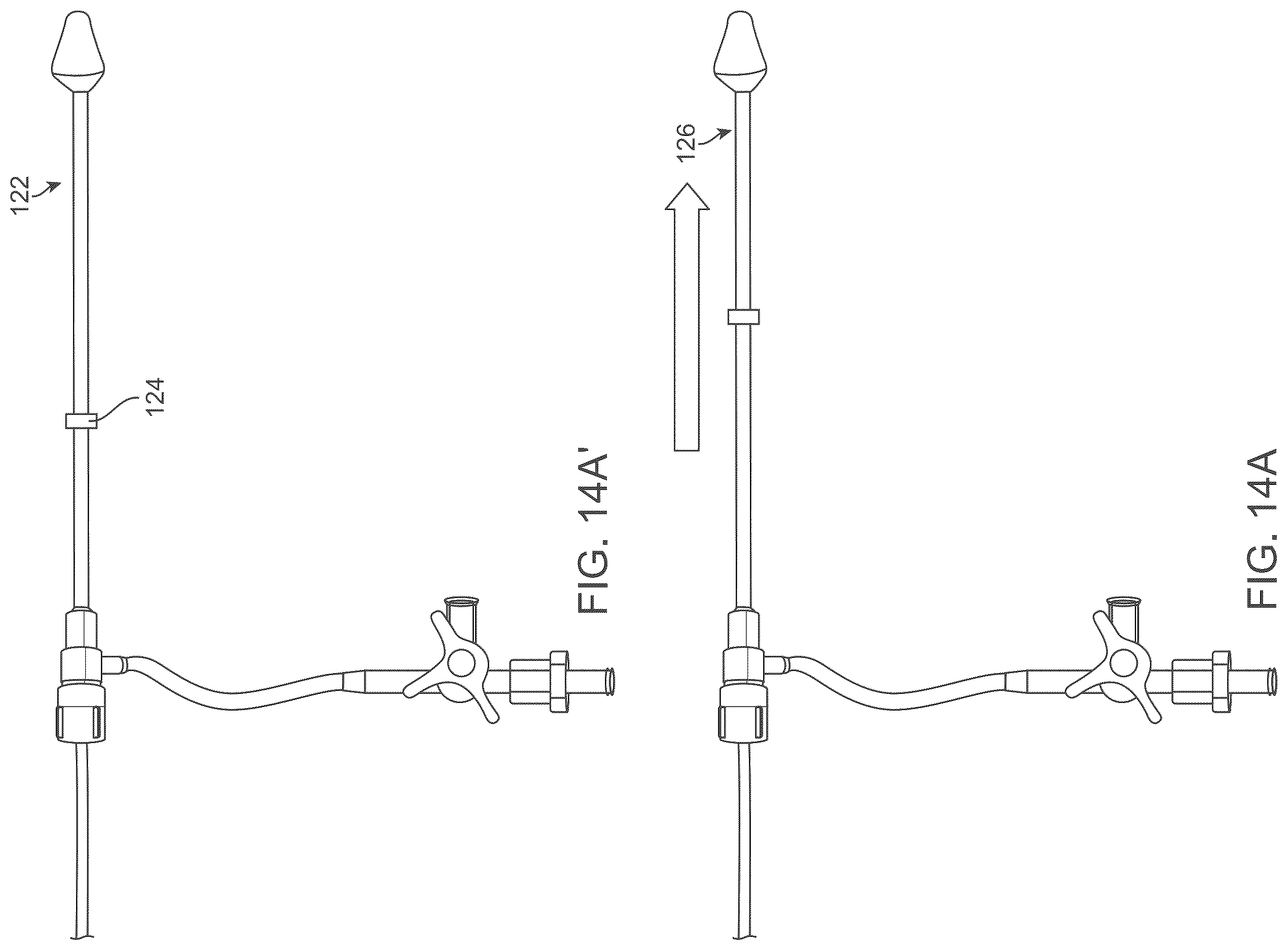 Patent US12588929 Figure 18 – Apparatus and method for everting catheter for embryo transfer using transvaginal ultrasound