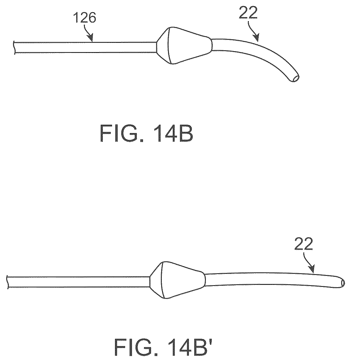 Patent US12588929 Figure 19 – Apparatus and method for everting catheter for embryo transfer using transvaginal ultrasound