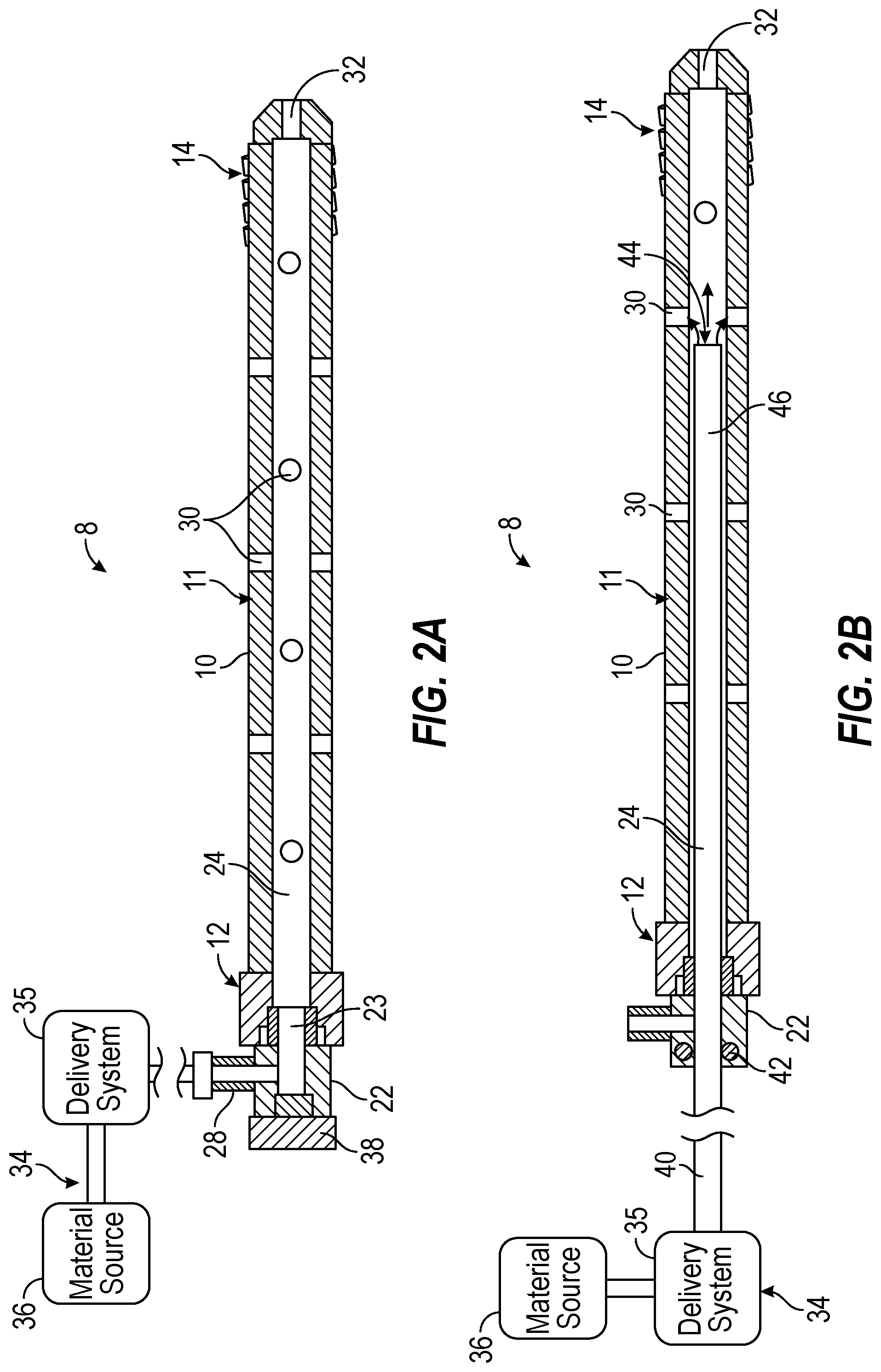 Patent US12588930 Figure 2 – Devices, systems, and methods of use for delivery of materials in combination with intramedullary devices