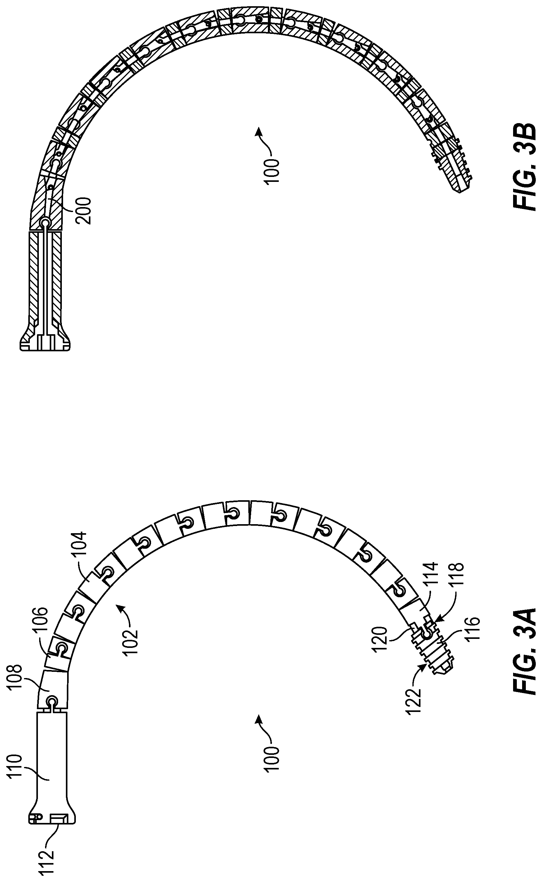 Patent US12588930 Figure 3 – Devices, systems, and methods of use for delivery of materials in combination with intramedullary devices