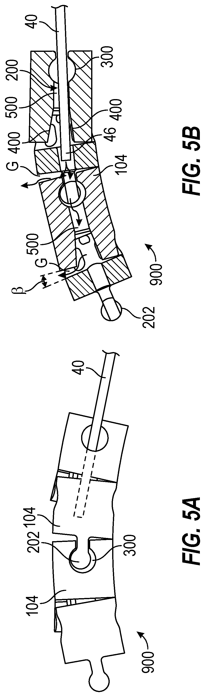 Patent US12588930 Figure 5 – Devices, systems, and methods of use for delivery of materials in combination with intramedullary devices