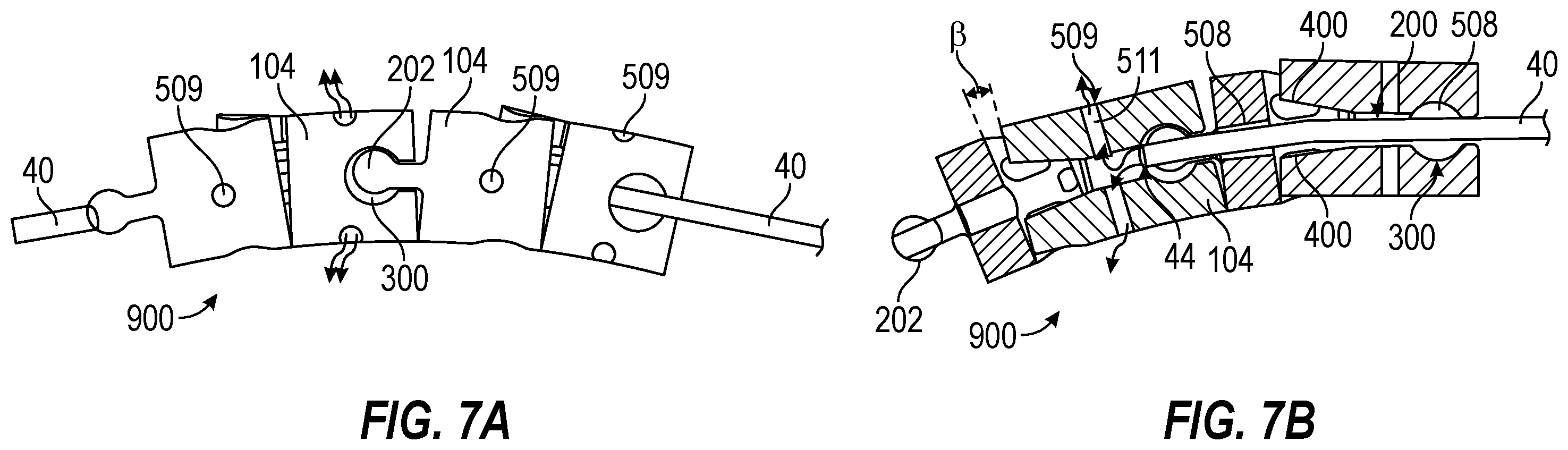 Patent US12588930 Figure 7 – Devices, systems, and methods of use for delivery of materials in combination with intramedullary devices