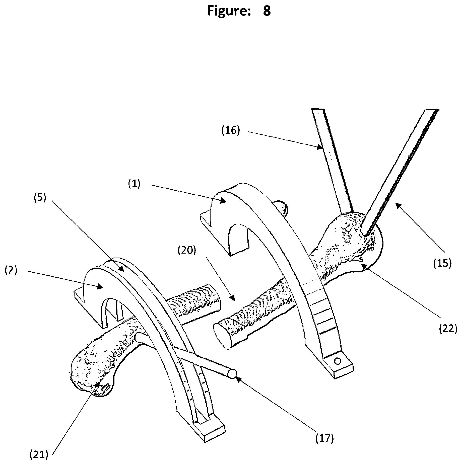 Patent US12588931 Figure 8 – Method and tool for measuring and correcting deformities for fractures and osteotomies