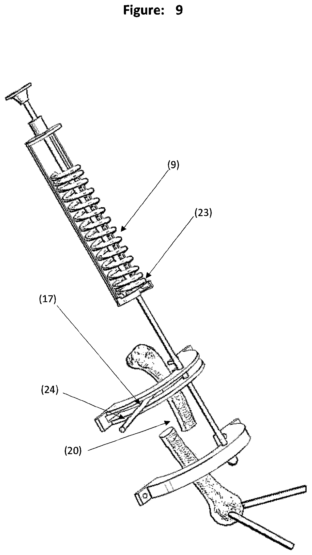 Patent US12588931 Figure 9 – Method and tool for measuring and correcting deformities for fractures and osteotomies