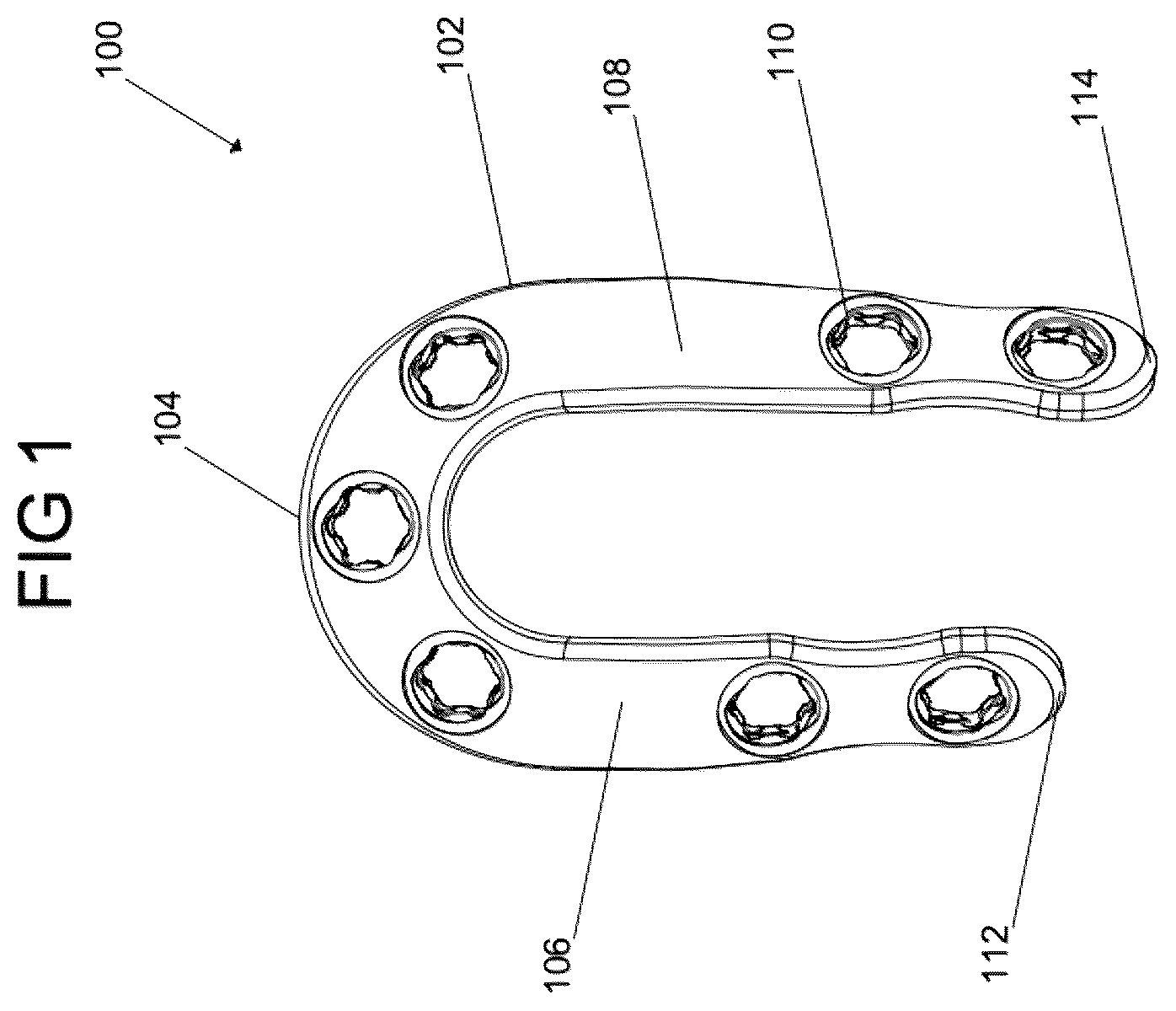 Patent US12588932 — Multi-planar fixation system — Figure 1