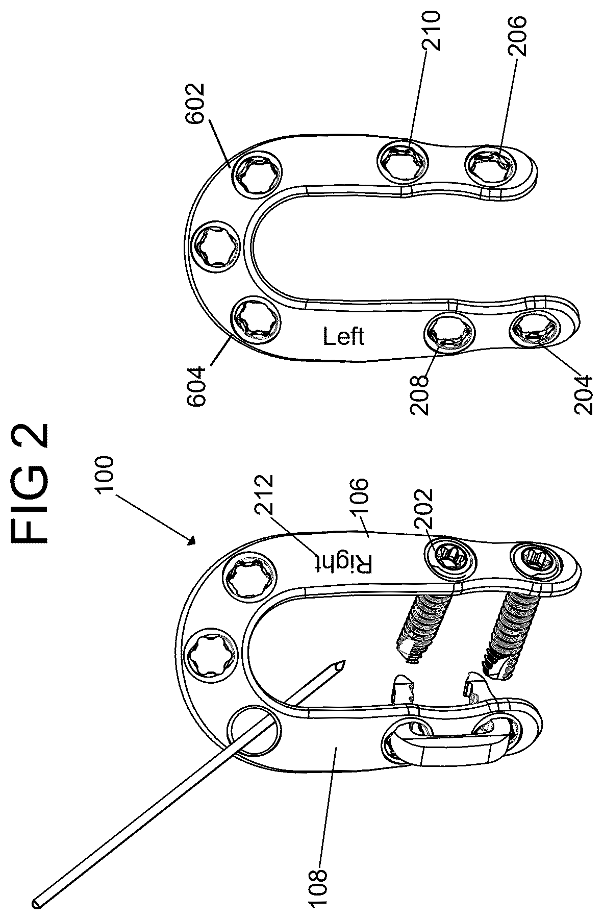 Patent US12588932 Figure 2 – Multi-planar fixation system